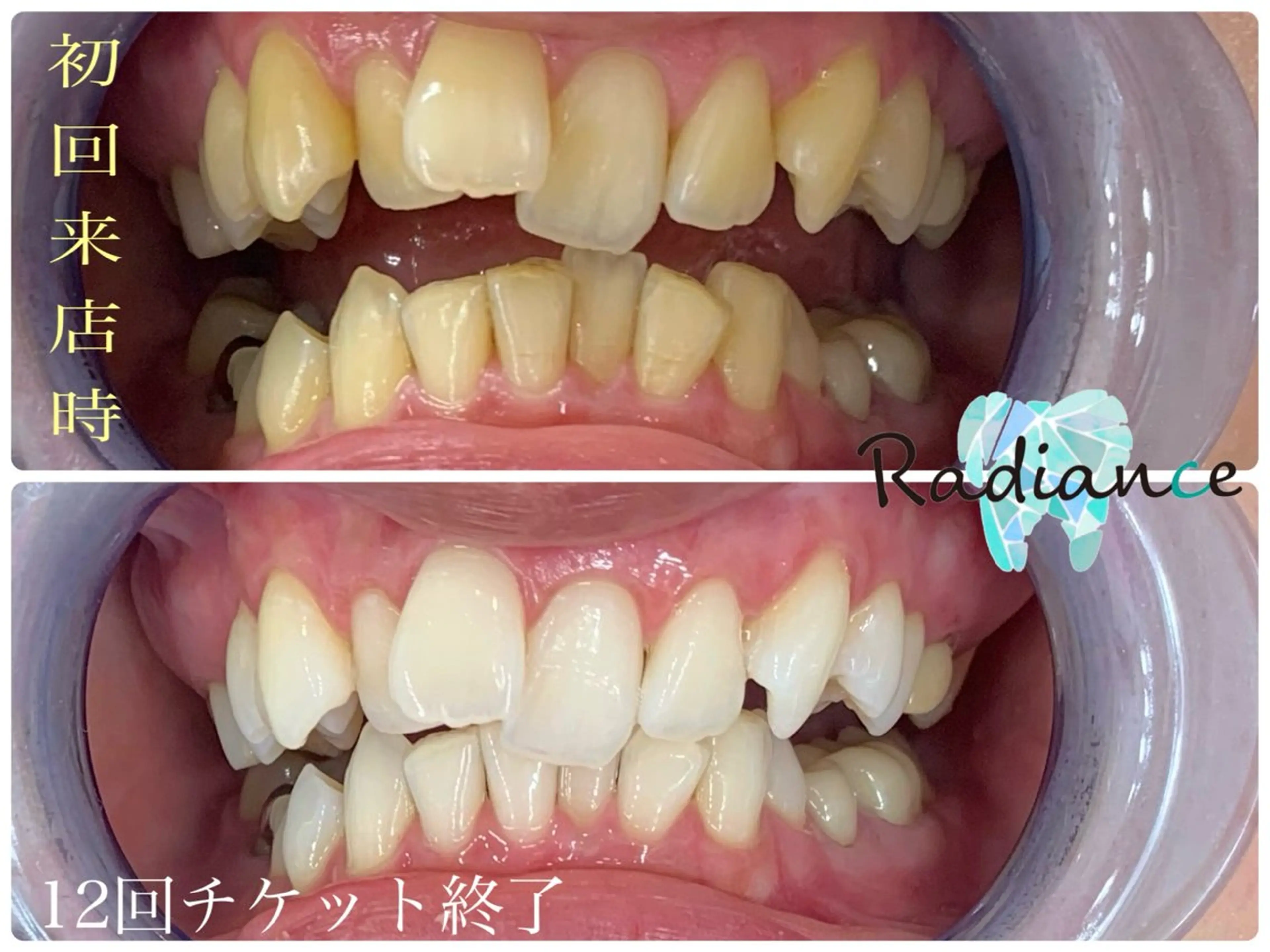 札幌ホワイトニング ラディアンス札幌駅店のその他イメージ