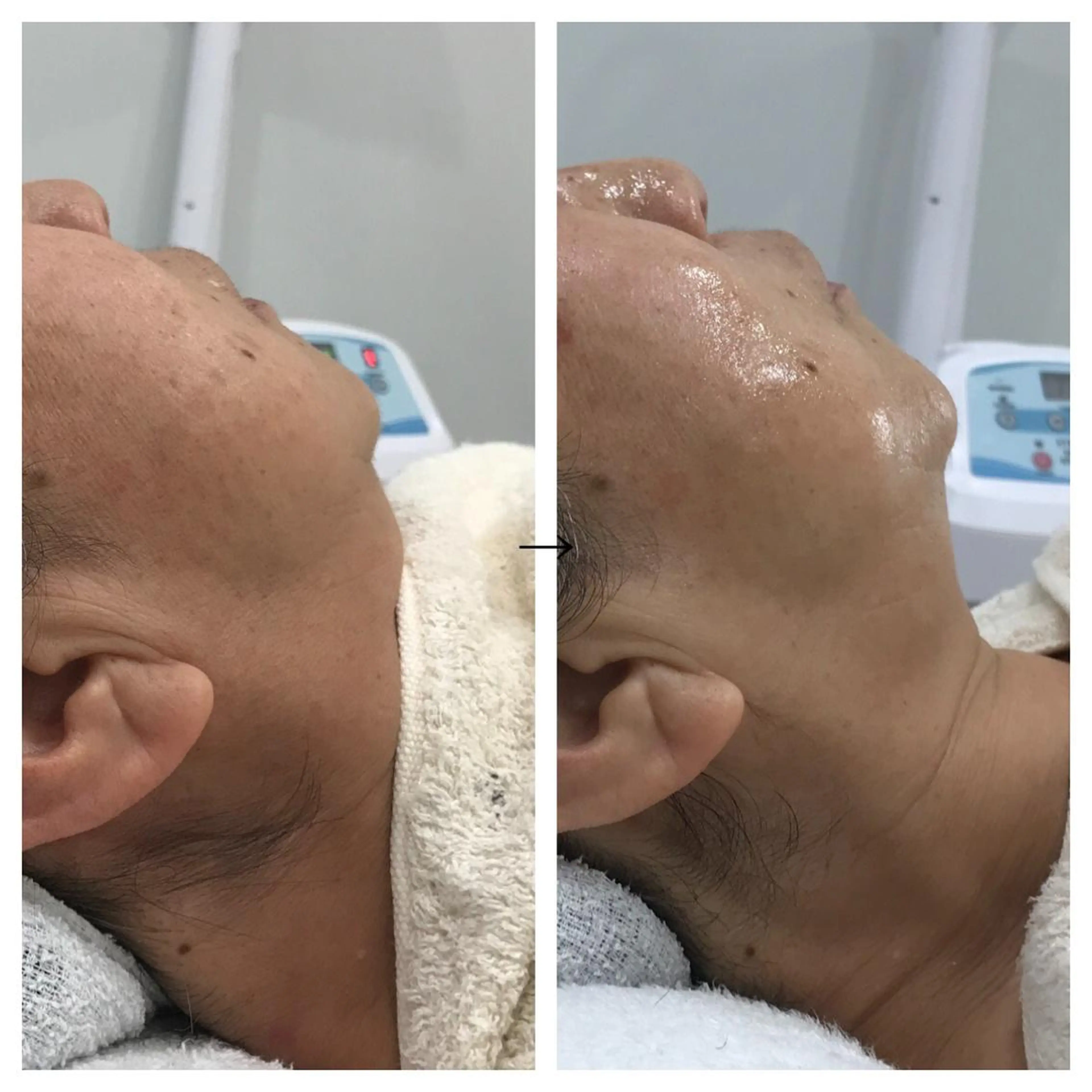 ビューティー ミロワールのエステ・リラクイメージ