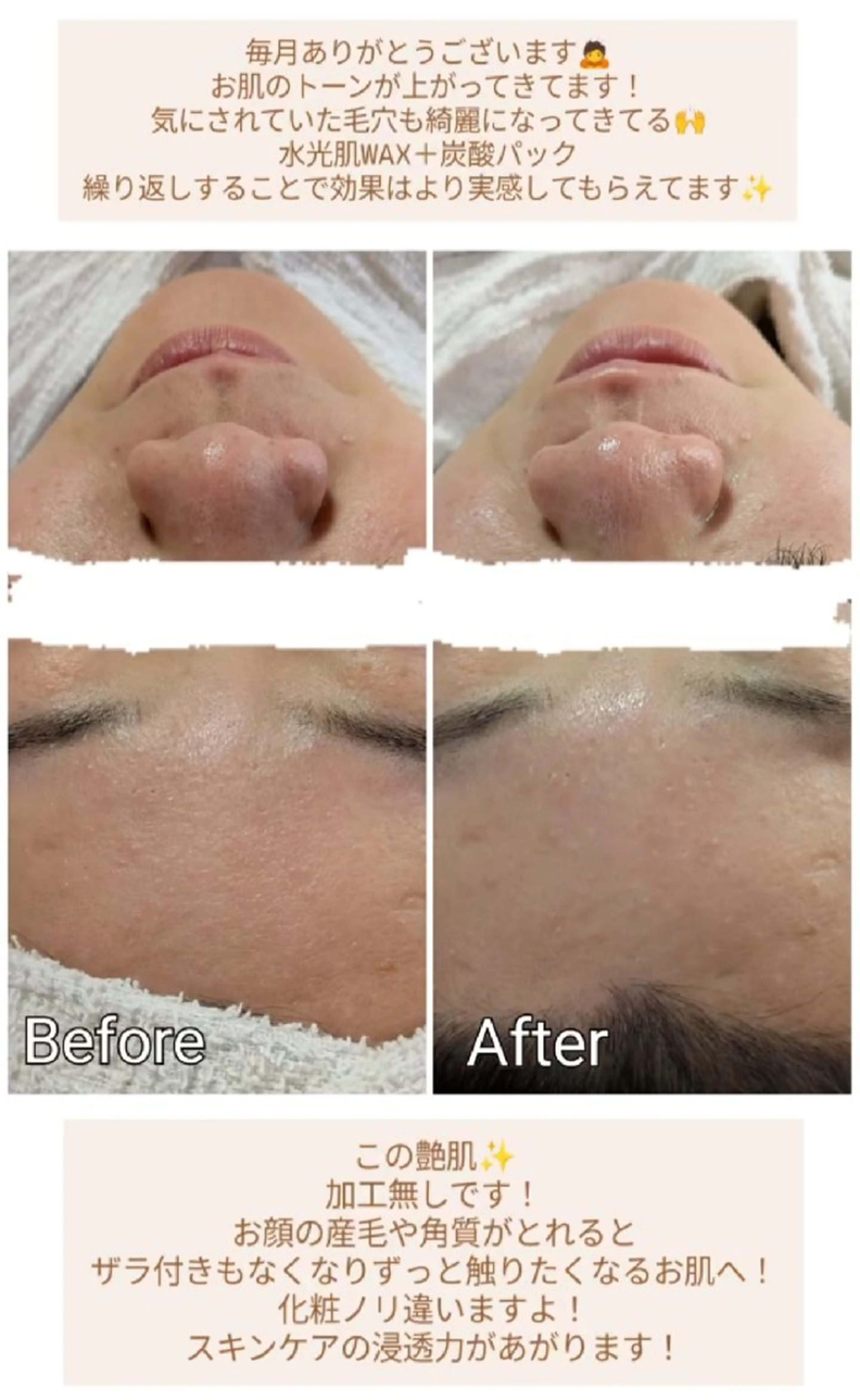 エステ Haru* Haruのエステ・リラクイメージ