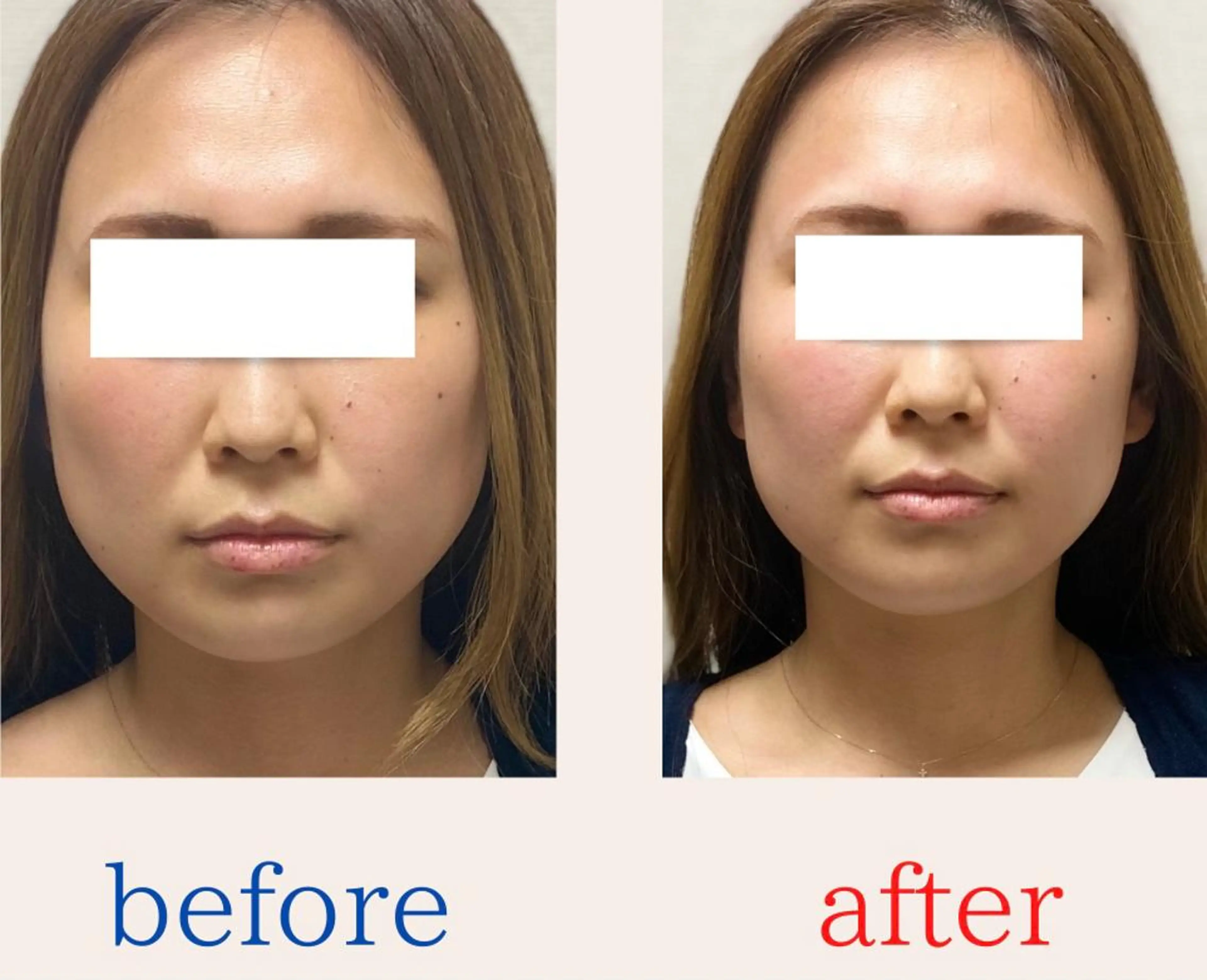 BEAUTY&HEALTH鍼灸院【春日部筋膜整体タケダ整体院】所属・武田 紘輝のエステ・リラクイメージ