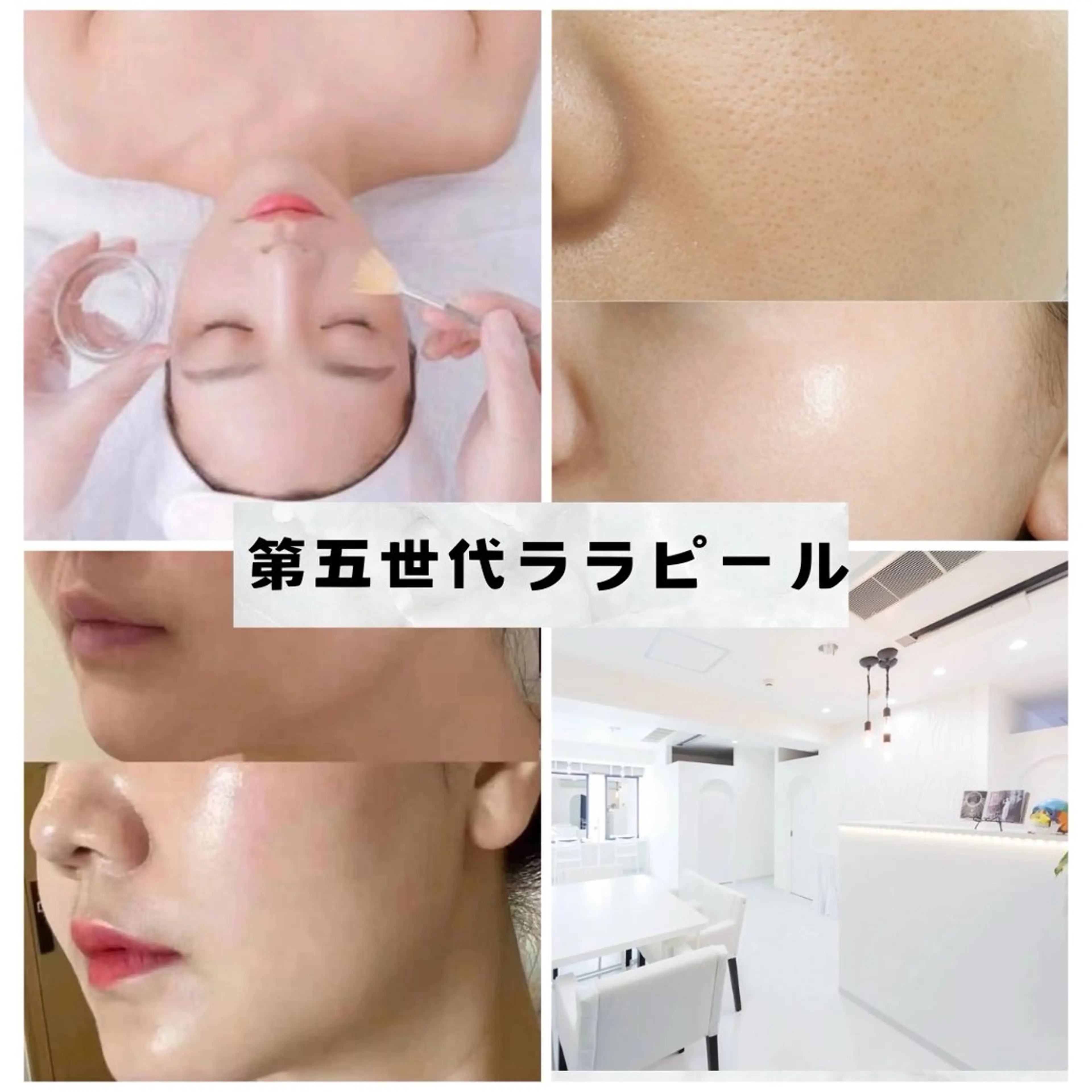 マツエク・マツパ エステ aliaハイフ&水光ジェットサロン所属・aliaハーブ水光店 エステティシャン募集のエステ・リラクイメージ