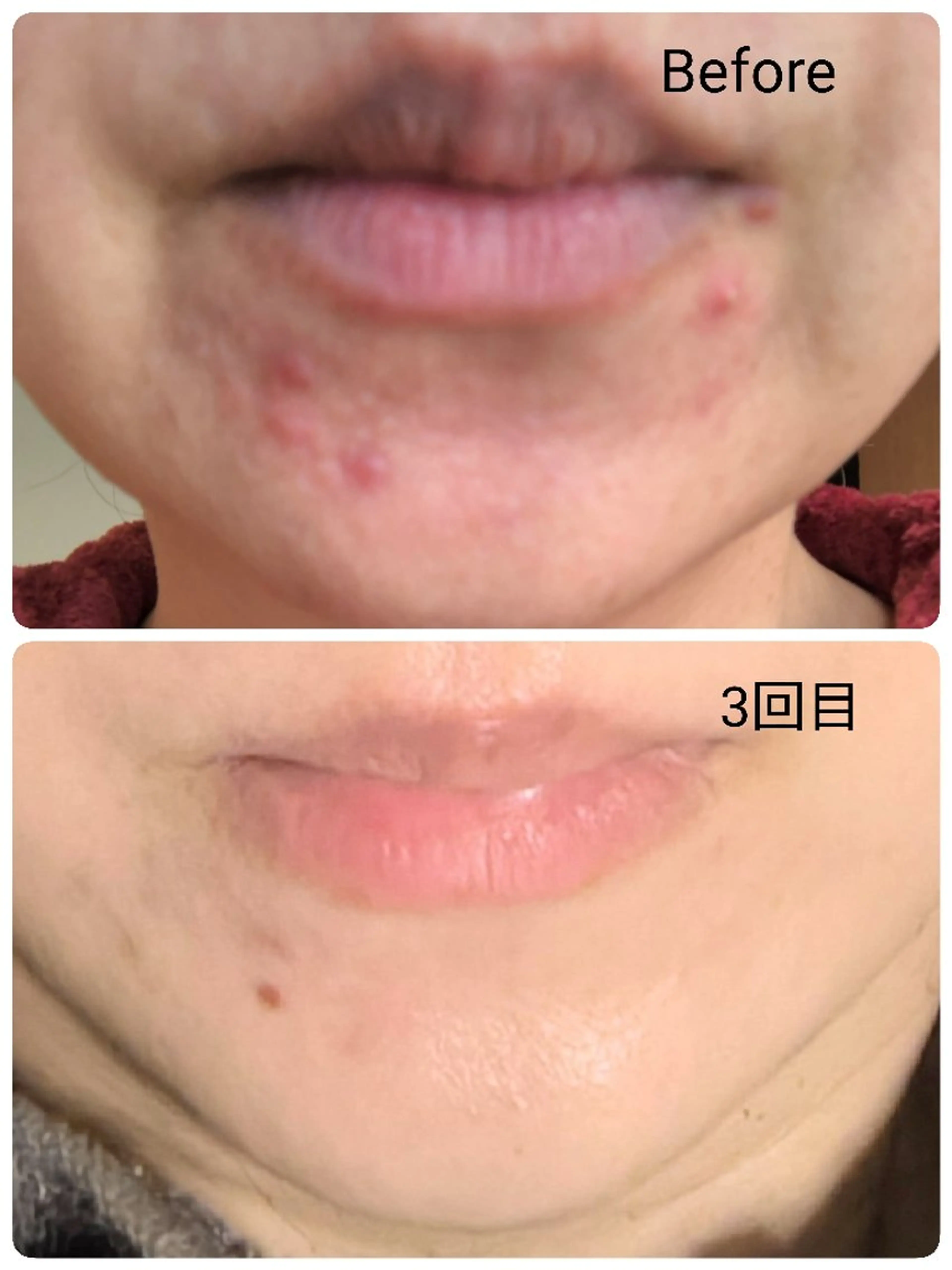 プライベートサロン✢ Eclatエクラ　のエステ・リラクイメージ