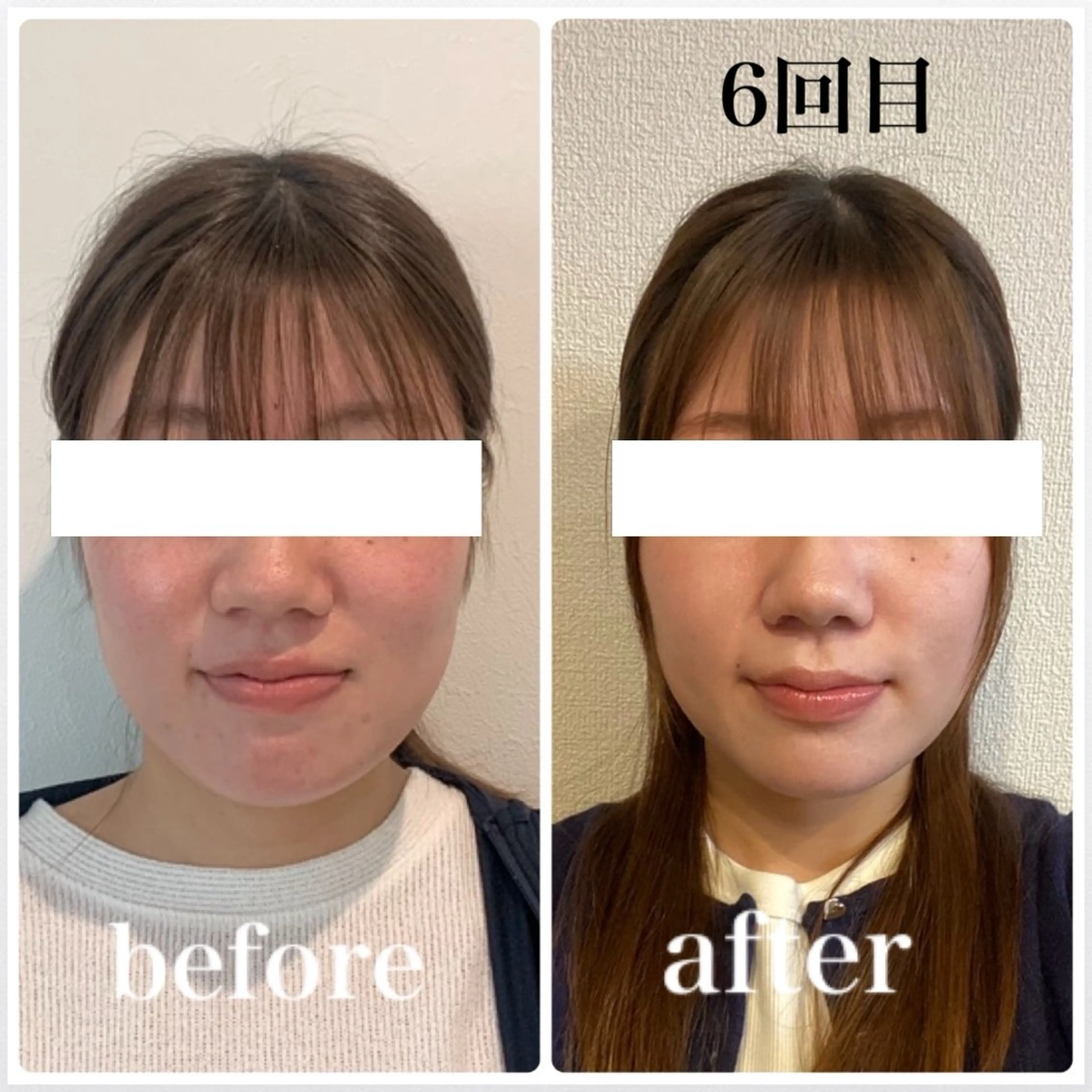 エステ リラク 小顔と ヘッドスパのお店のエステ・リラクイメージ