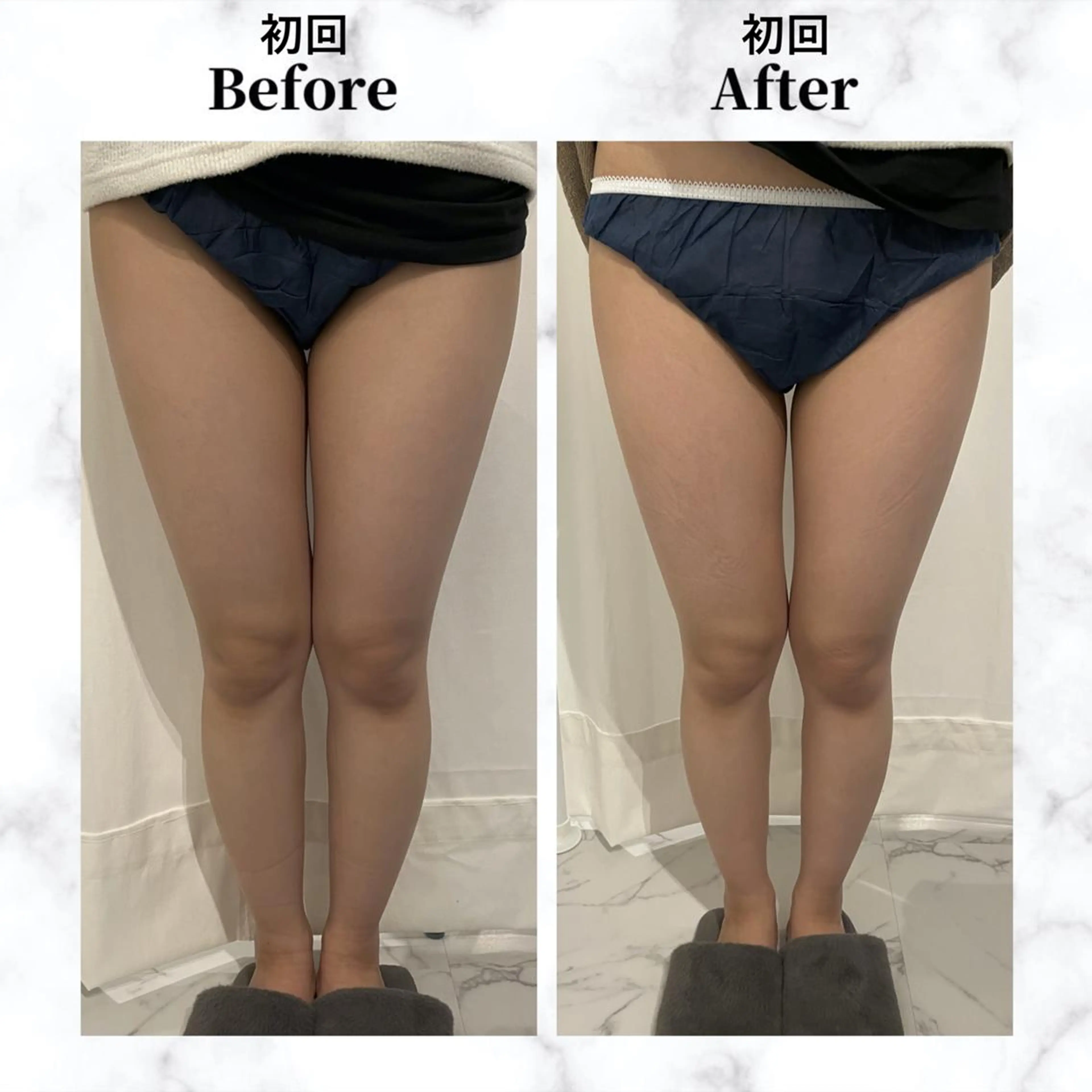 エステ リラク 12Dハイフ💗 最強小顔のエステ・リラクイメージ