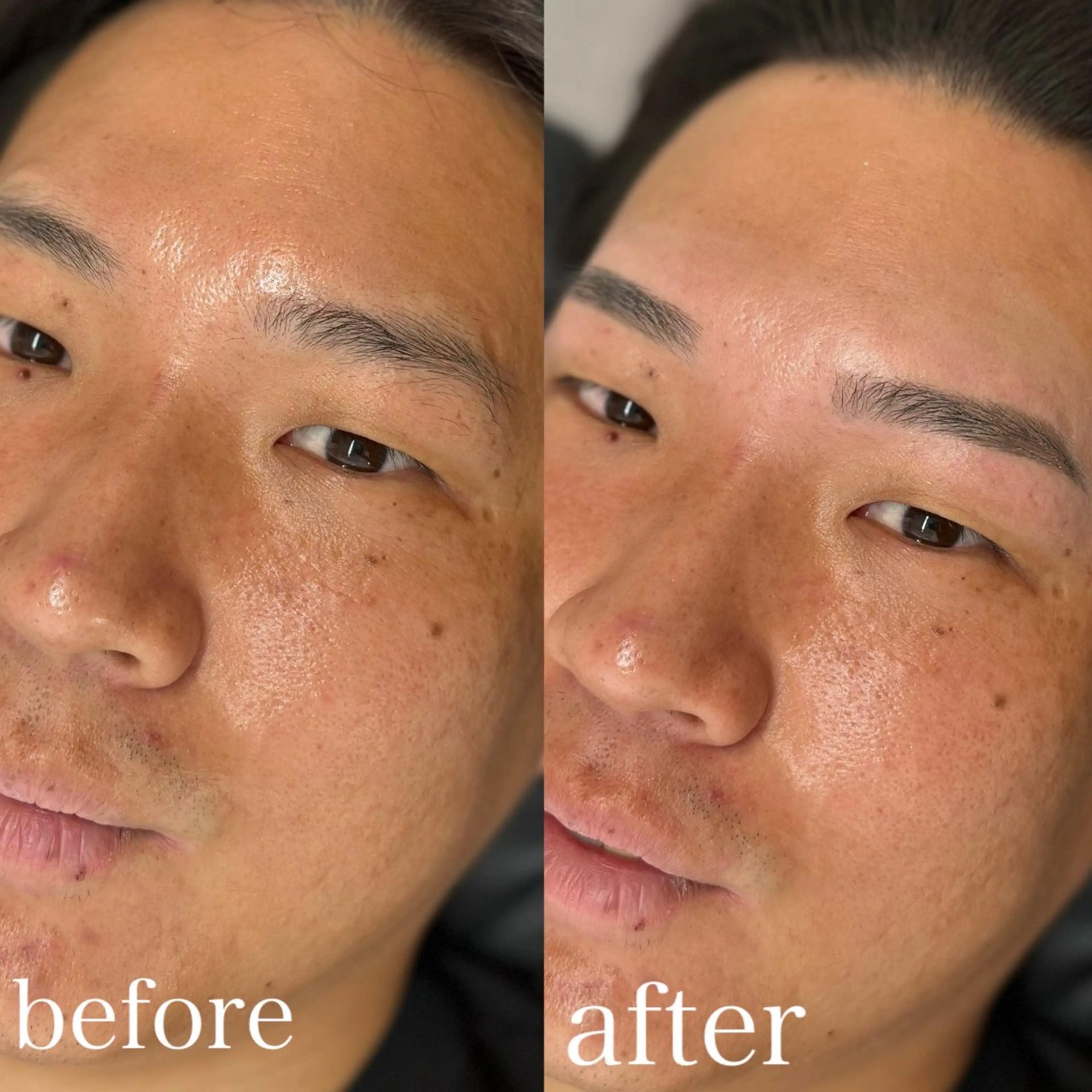 メンズ アイブロウ メンズアイブロウ 眉毛ワックス脱毛 MIHO ミホの眉毛・アイブロウイメージ