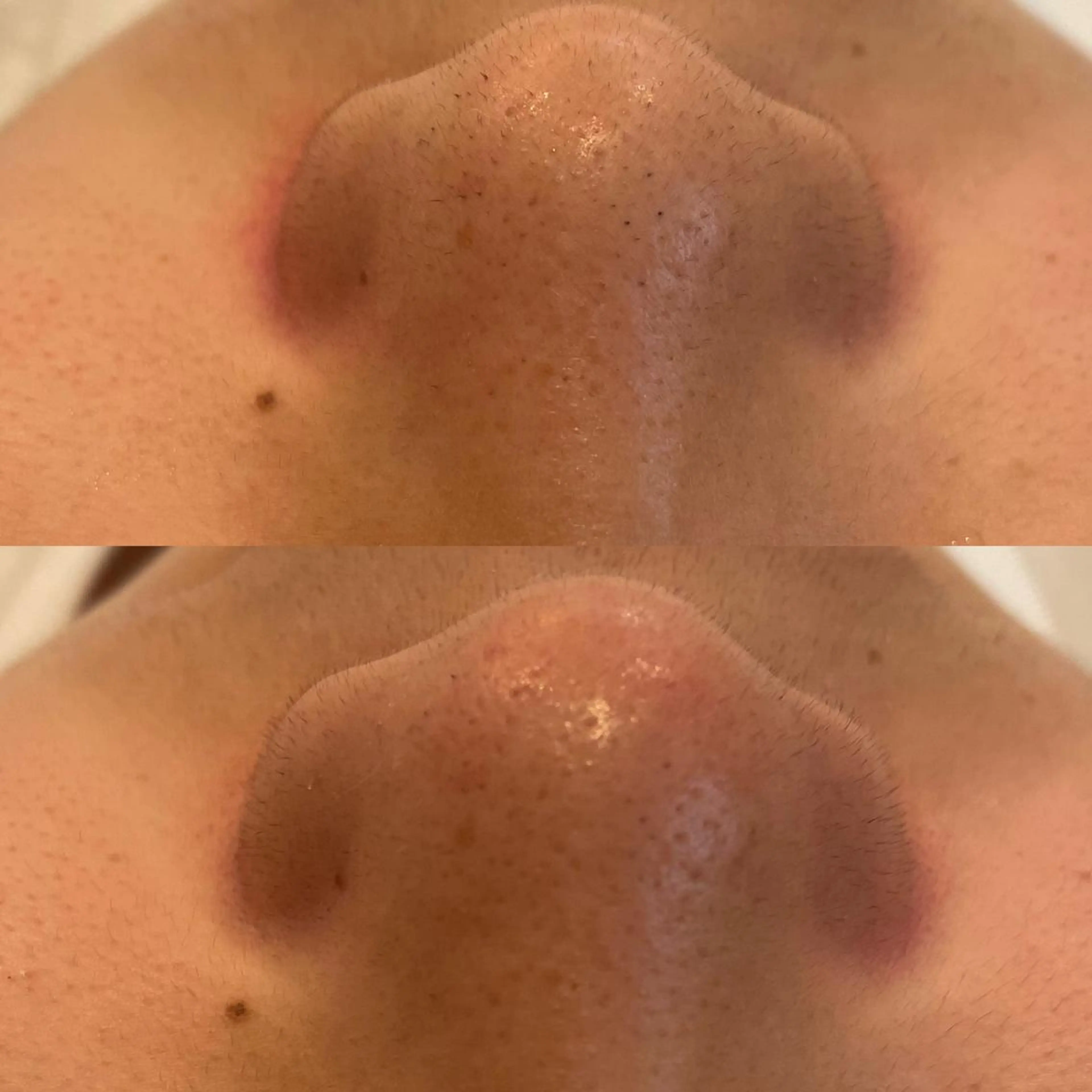 VERY VERY 九条店のエステ・リラクイメージ