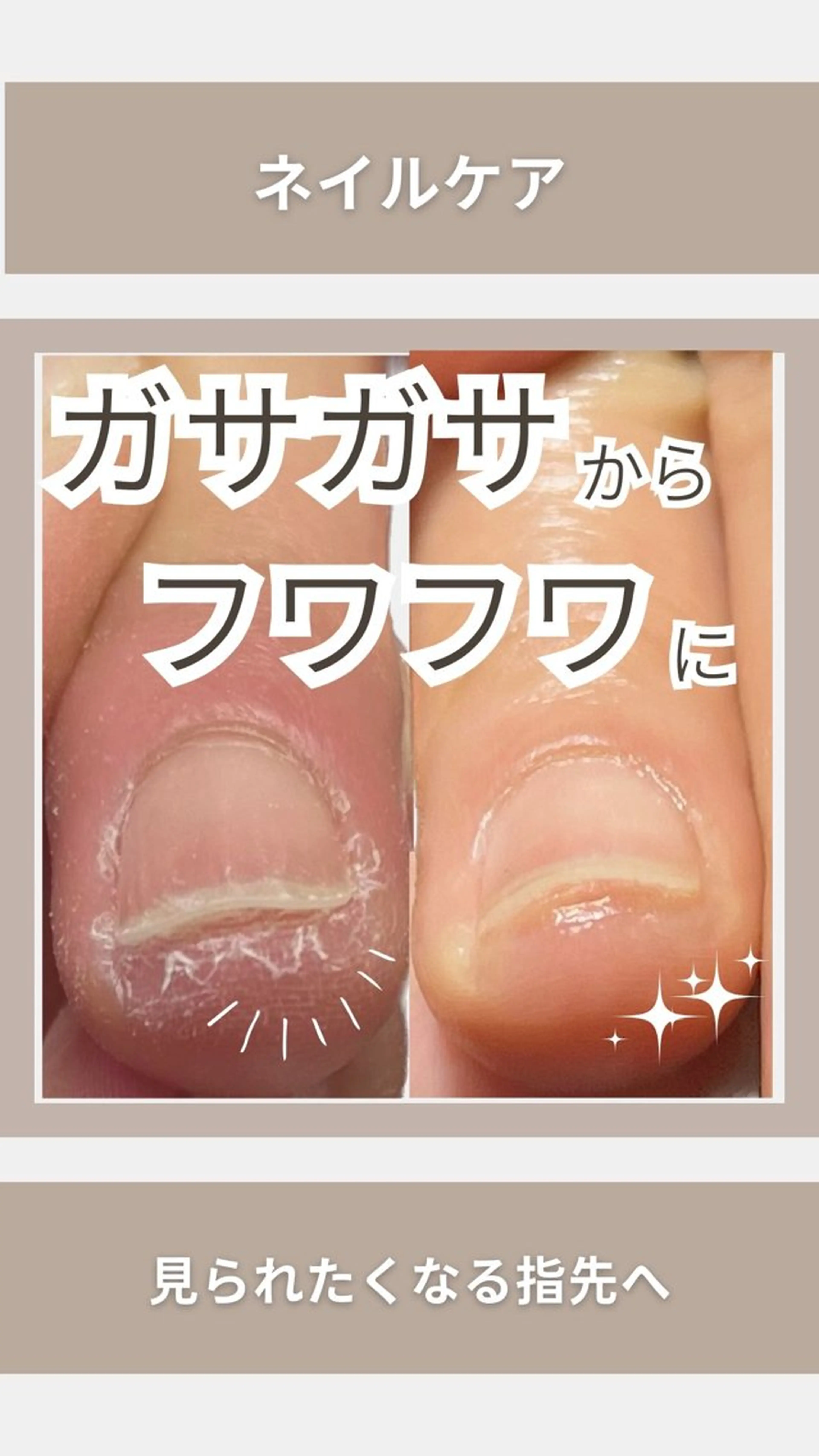 【ﾈｲﾙｹｱで自爪育成をしたい人向け】ネイルケアの写真