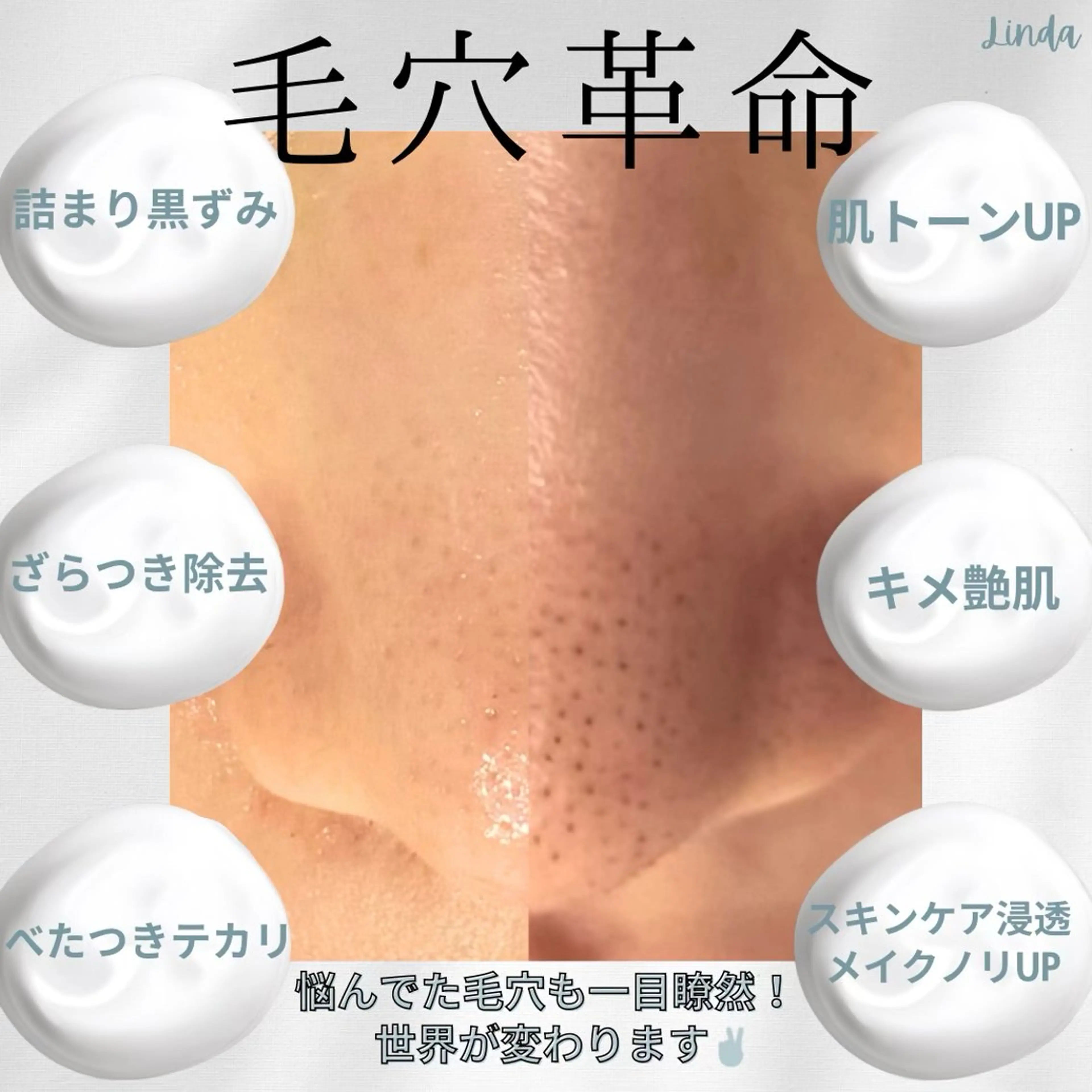 エステ 小顔&毛穴・肌質改善 LINDA西宮 AIのエステ・リラクイメージ