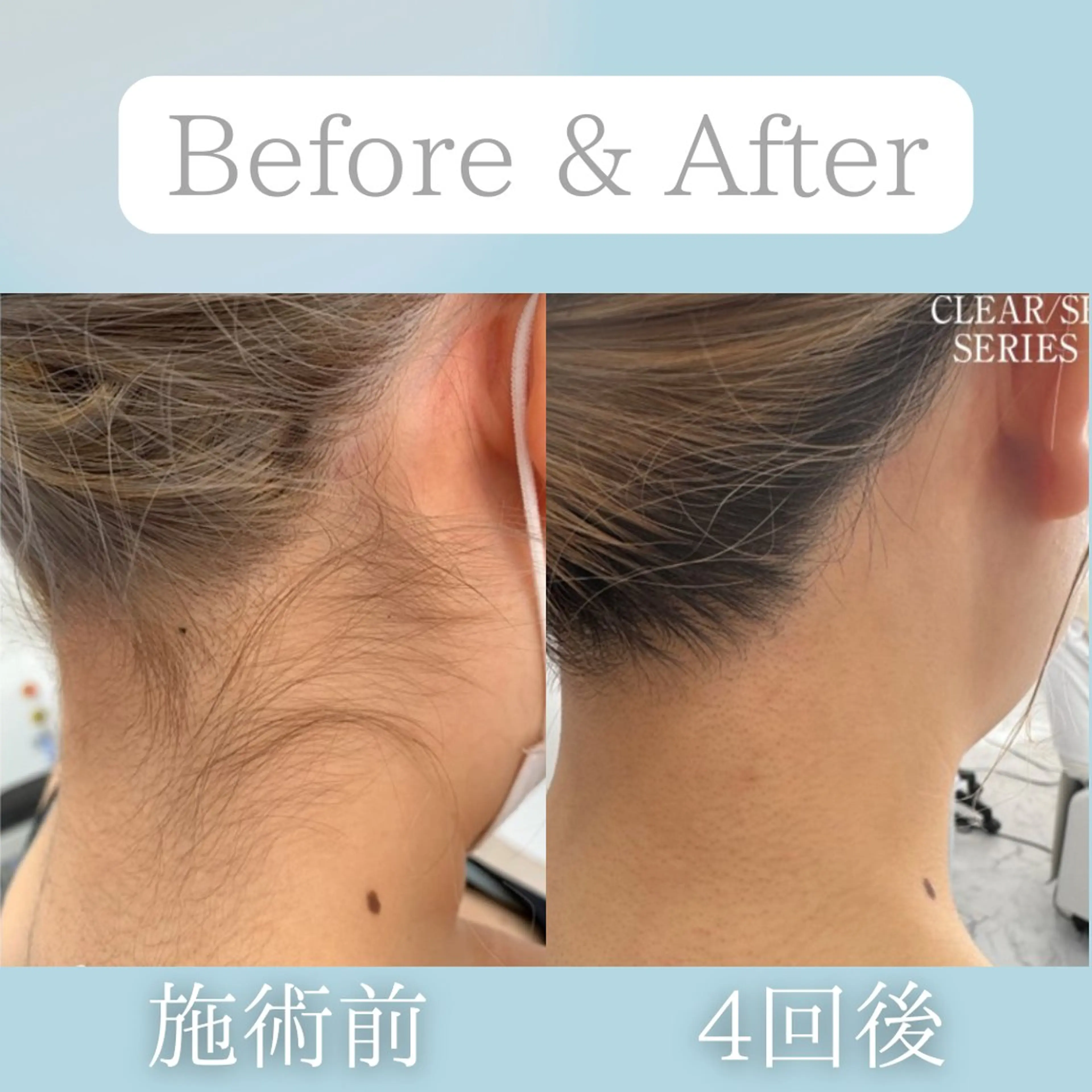 美肌脱毛&毛穴専門 Nico🐰ྀི♡のエステ・リラクイメージ