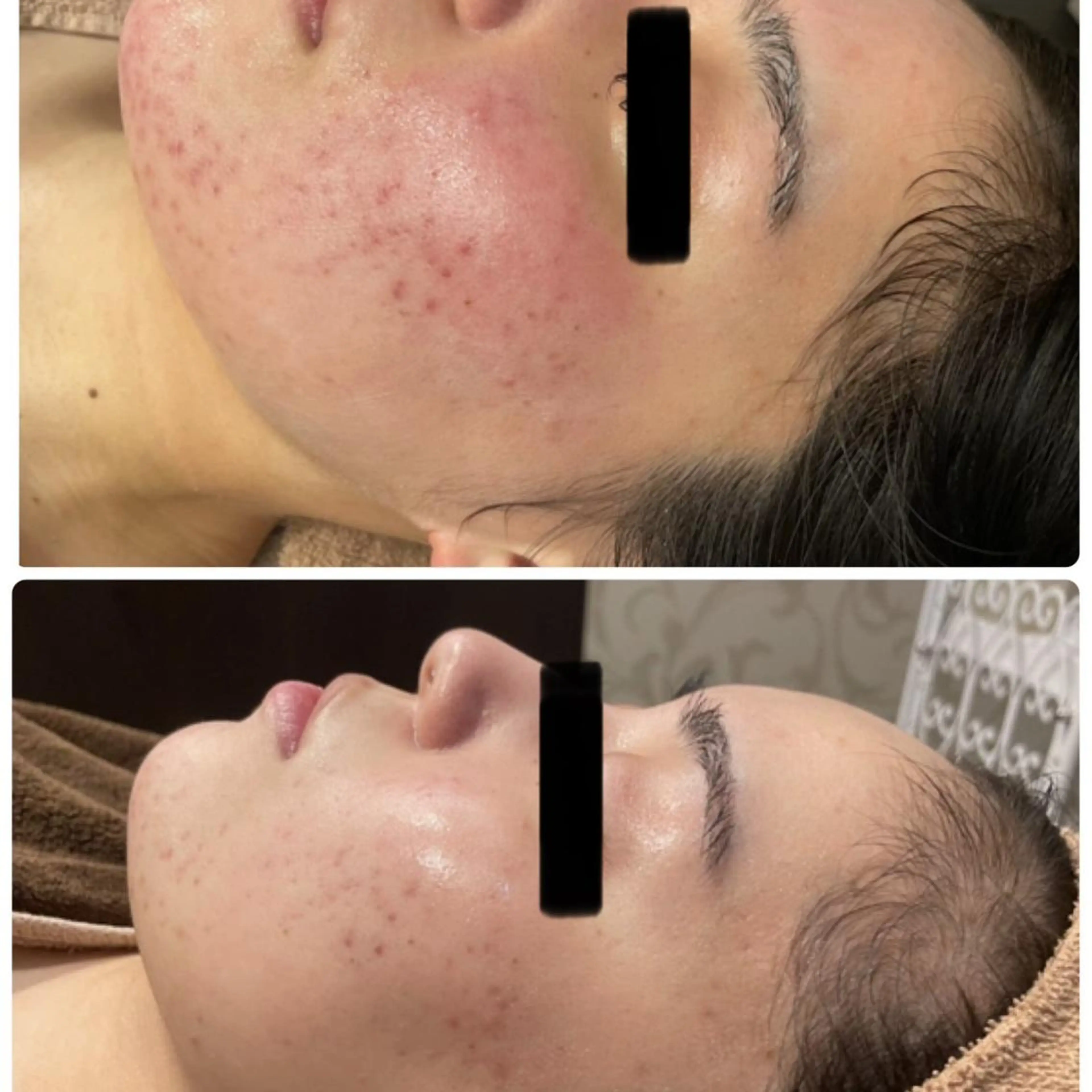 エステ リラク RAYVIS梅田店 HARUのエステ・リラクイメージ