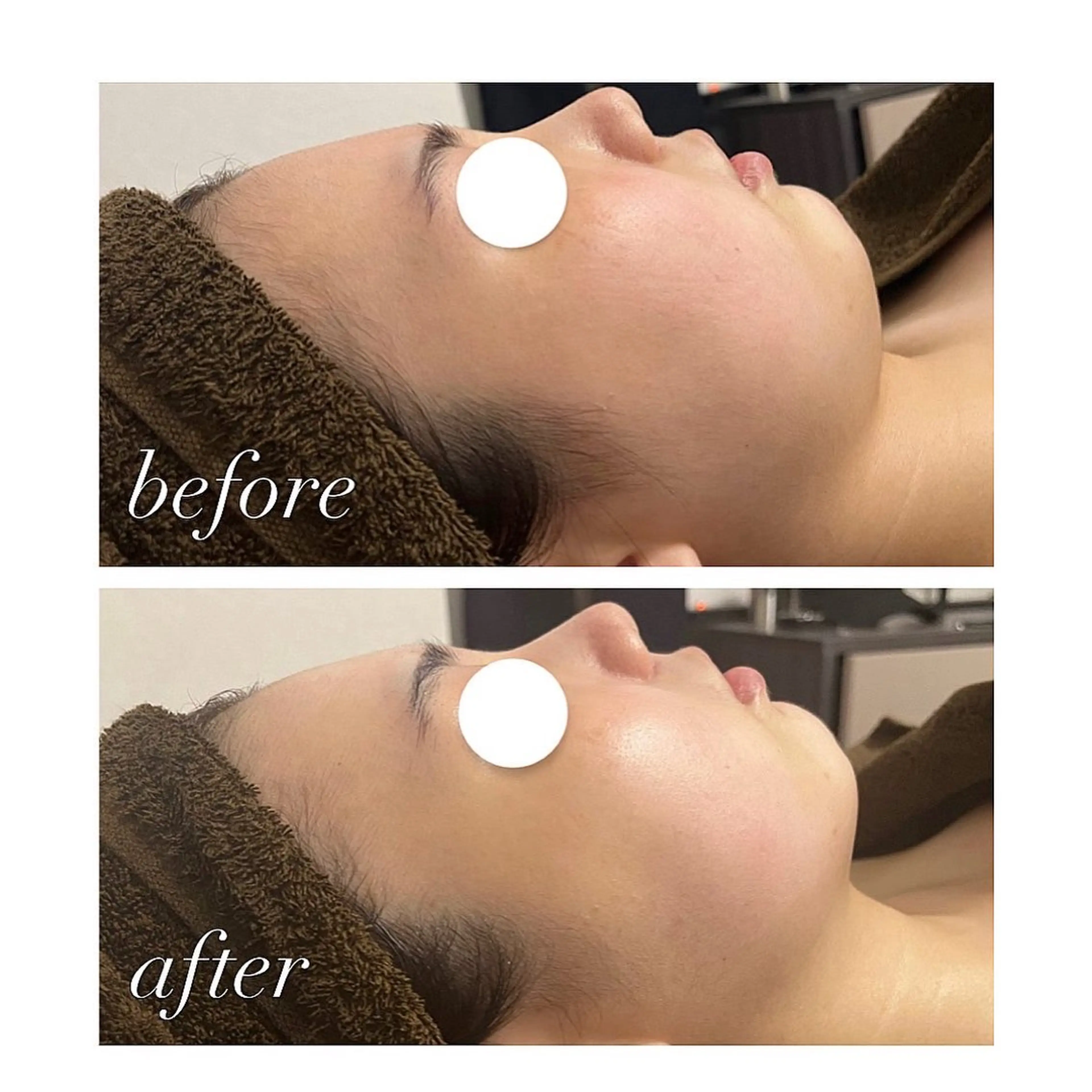 エステ 表参道エステサロン &BEAUTÉのエステ・リラクイメージ