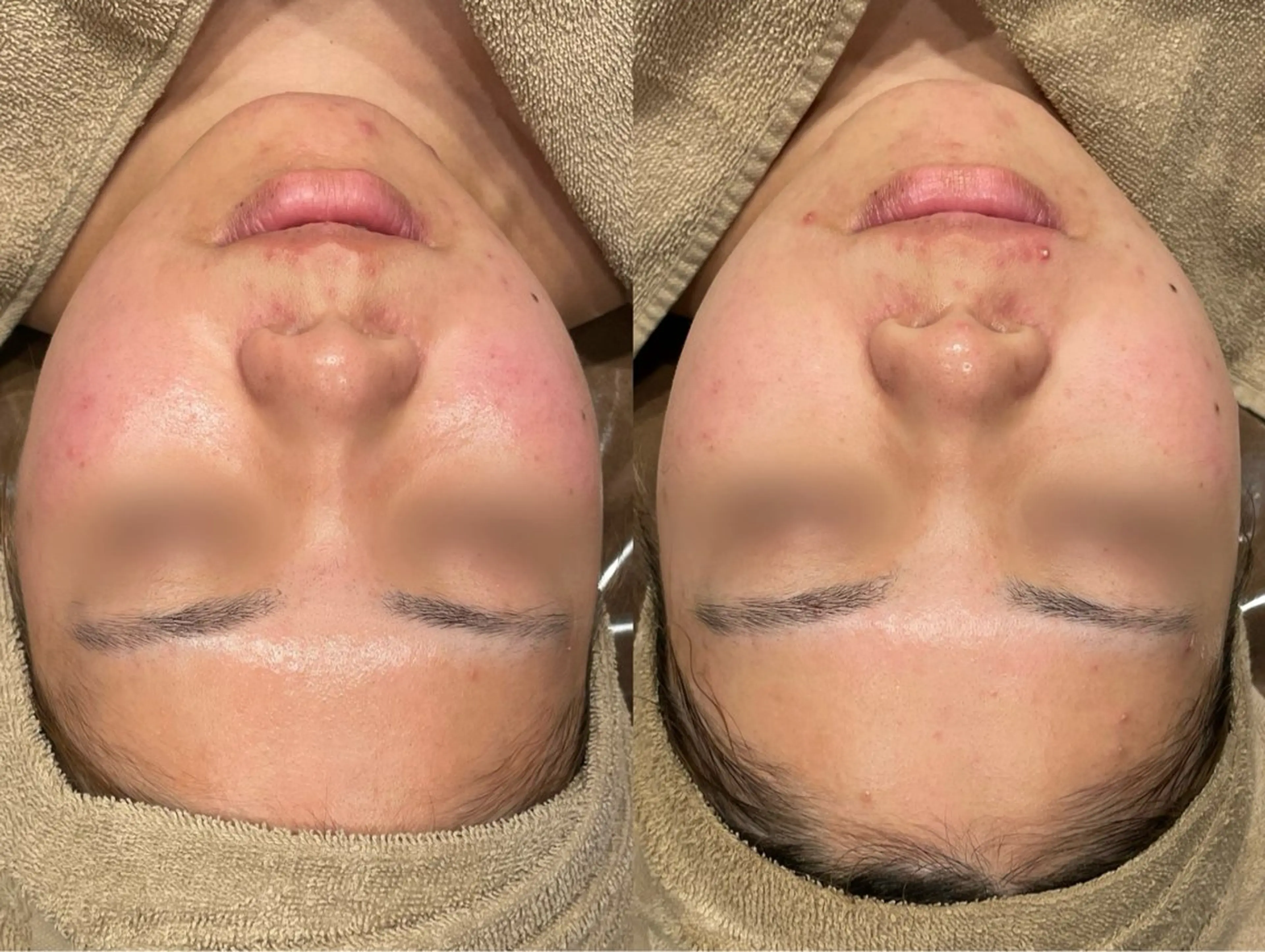 エステ Re:Belle所属・Re:Belle 久留米 : 中島のエステ・リラクイメージ