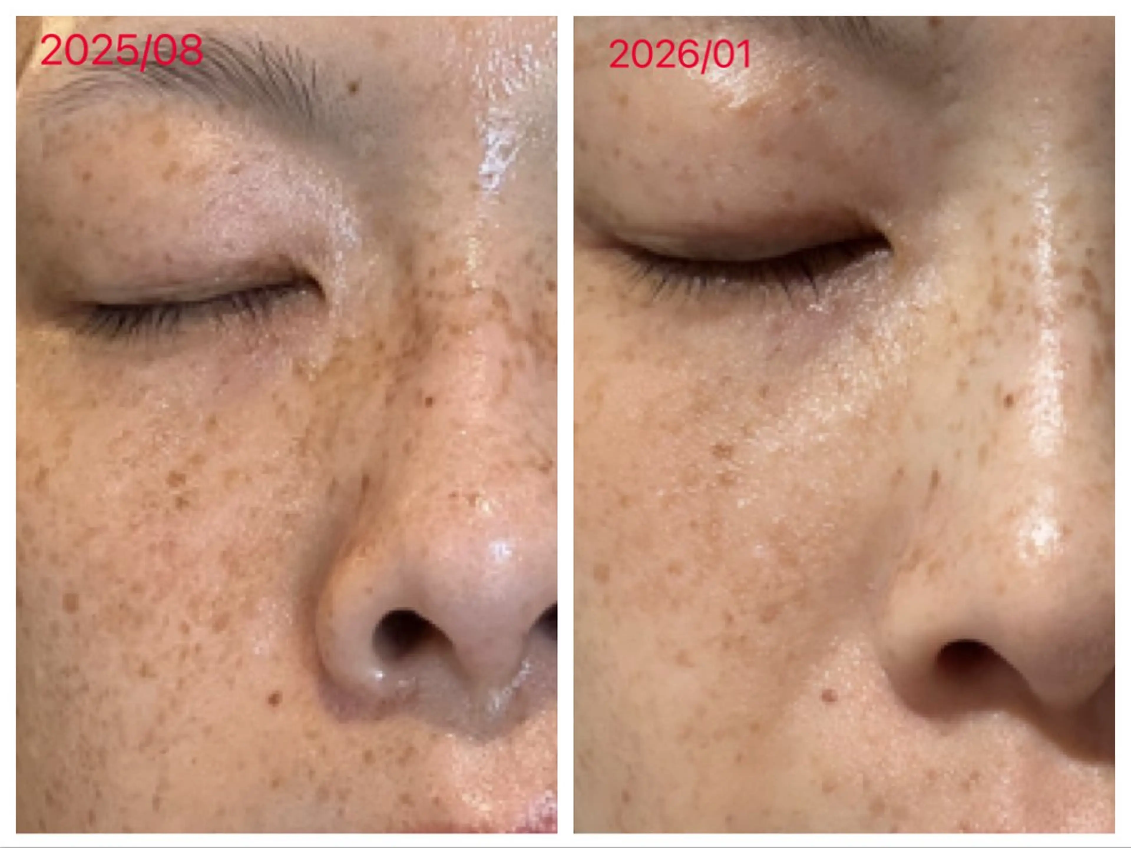 エステ 斉喜 明音のエステ・リラクイメージ