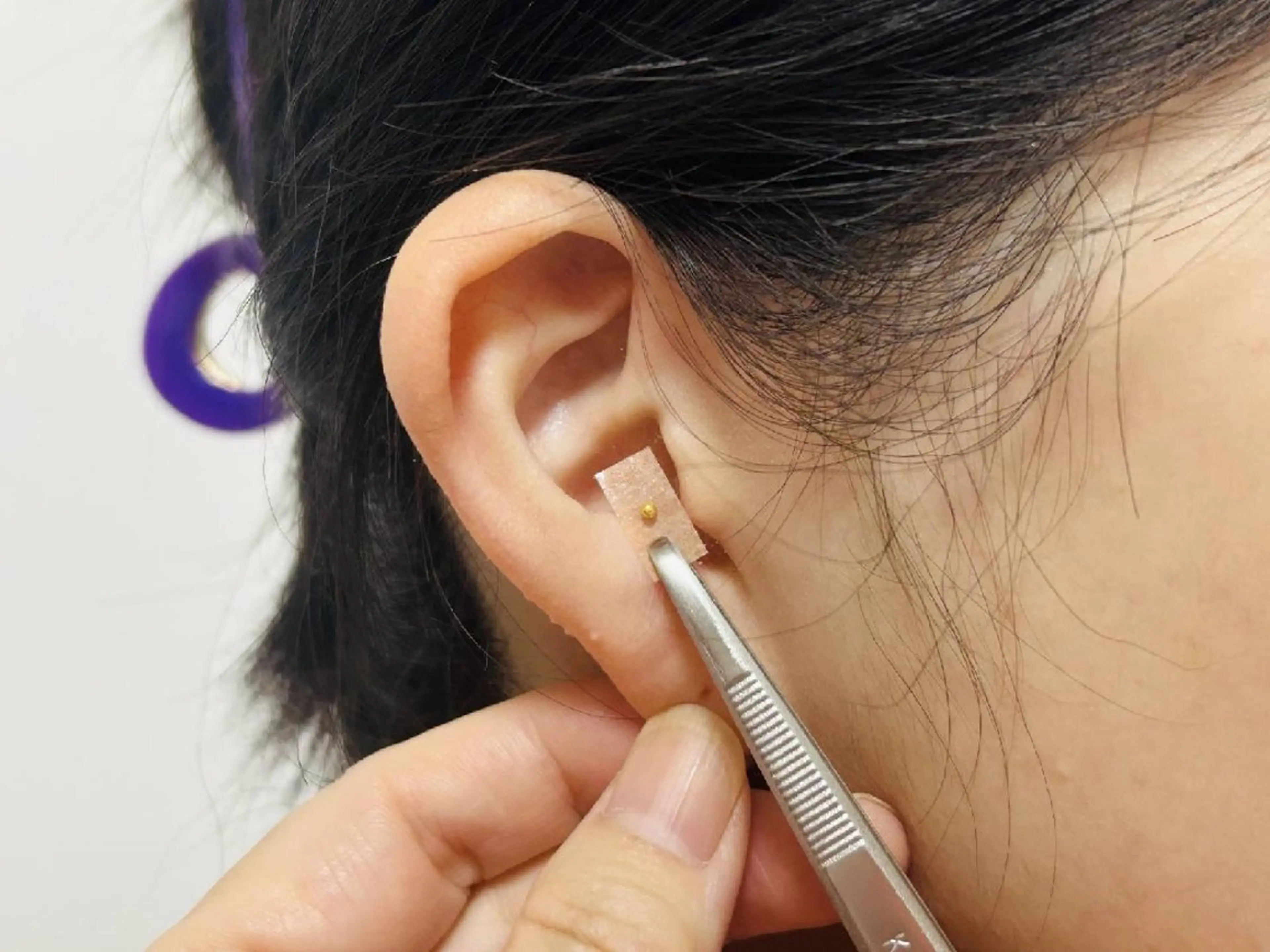 【本気のスリム作戦！】カウンセリング+耳ツボ施術の写真