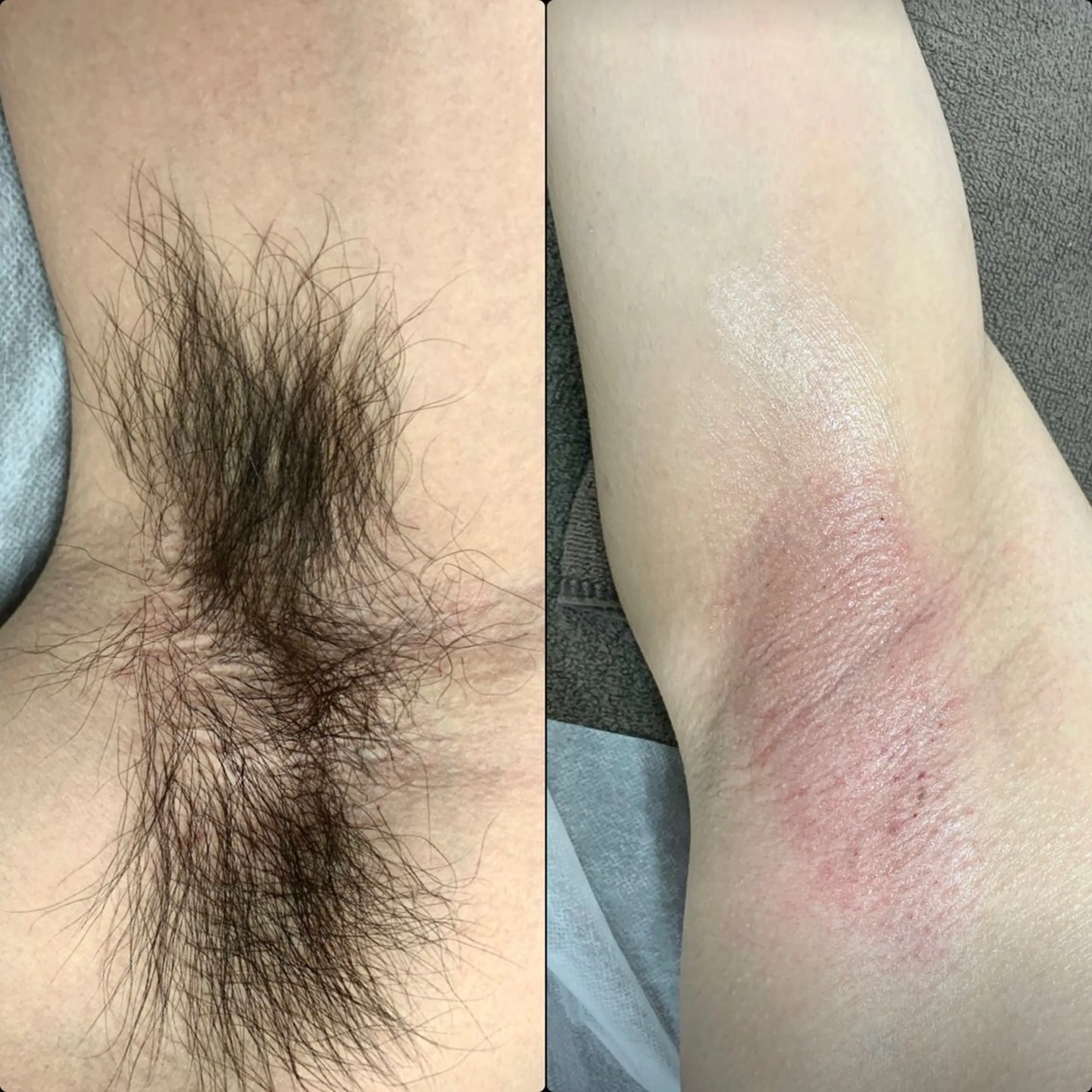 六本木脱毛andS さおりのエステ・リラクイメージ