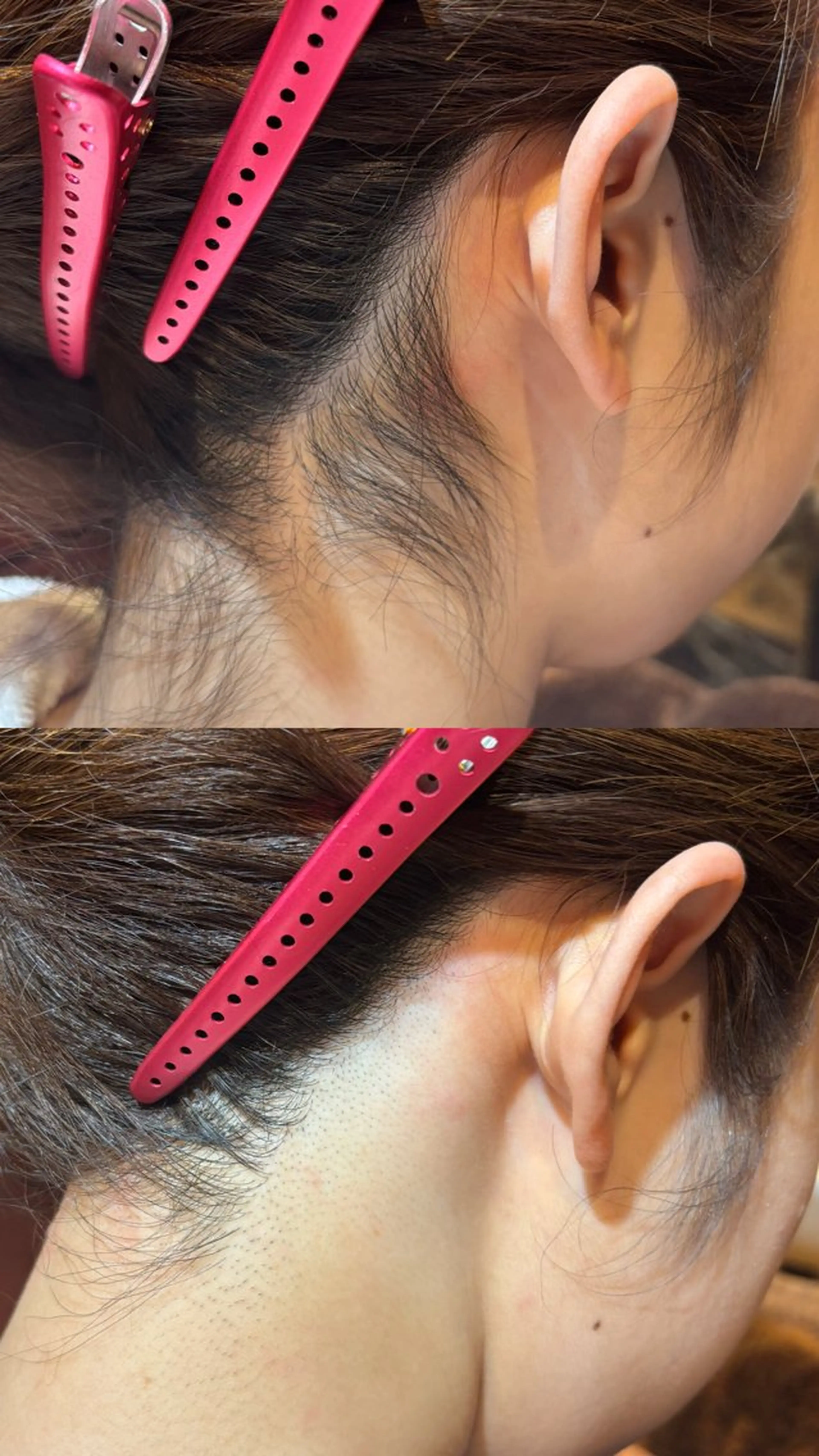 脱毛 佐藤 真帆のエステ・リラクイメージ