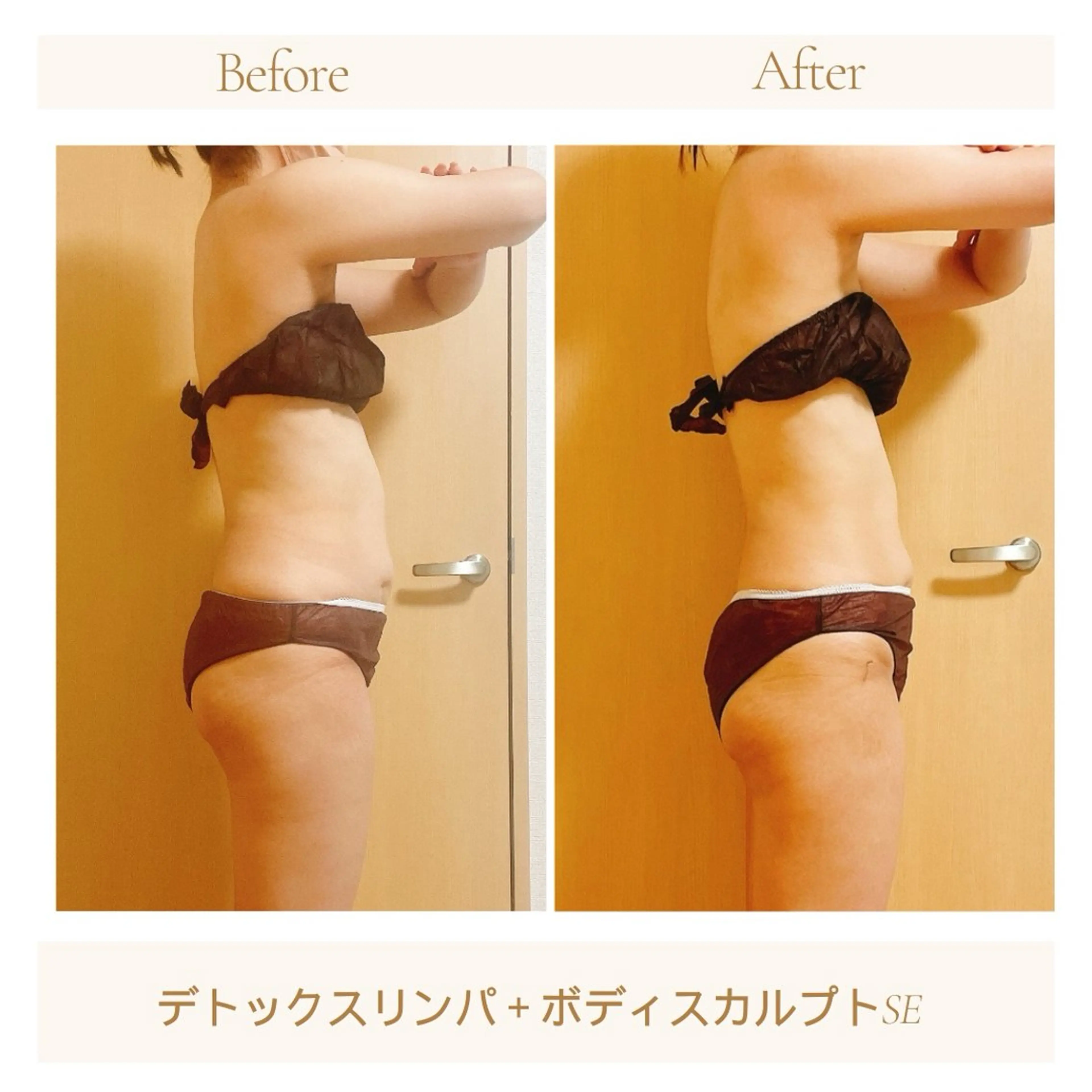 小顔・デトックスリンパ専門サロンRadiant Muse (ラディアントミューズ)所属・小顔・たるみ改善 ラディアントミューズのエステ・リラクイメージ