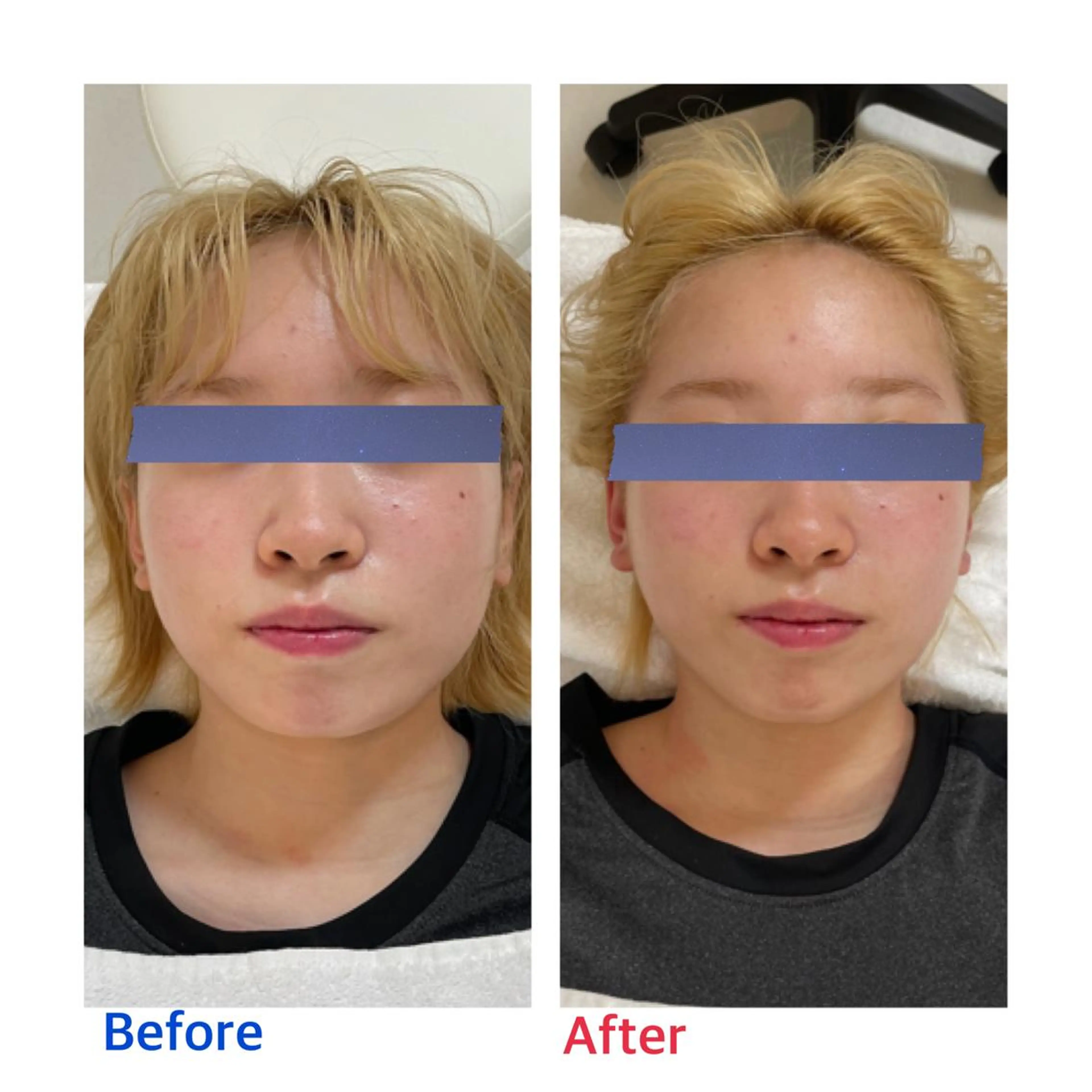 エステ リラク プライベートサロン moyoのエステ・リラクイメージ