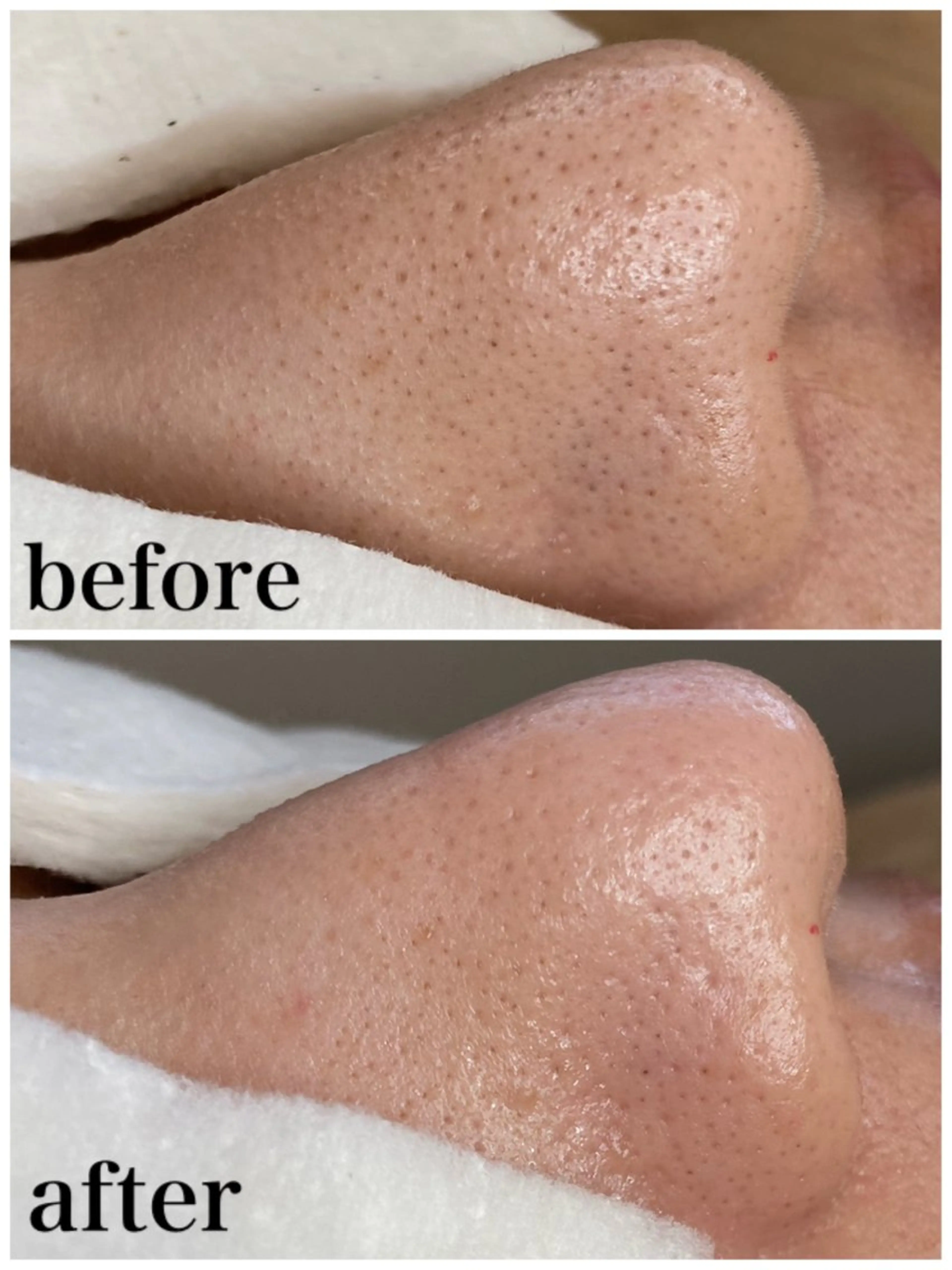 マツエク・マツパ エステ リラク 韓国肌管理 【毛穴専科】のエステ・リラクイメージ