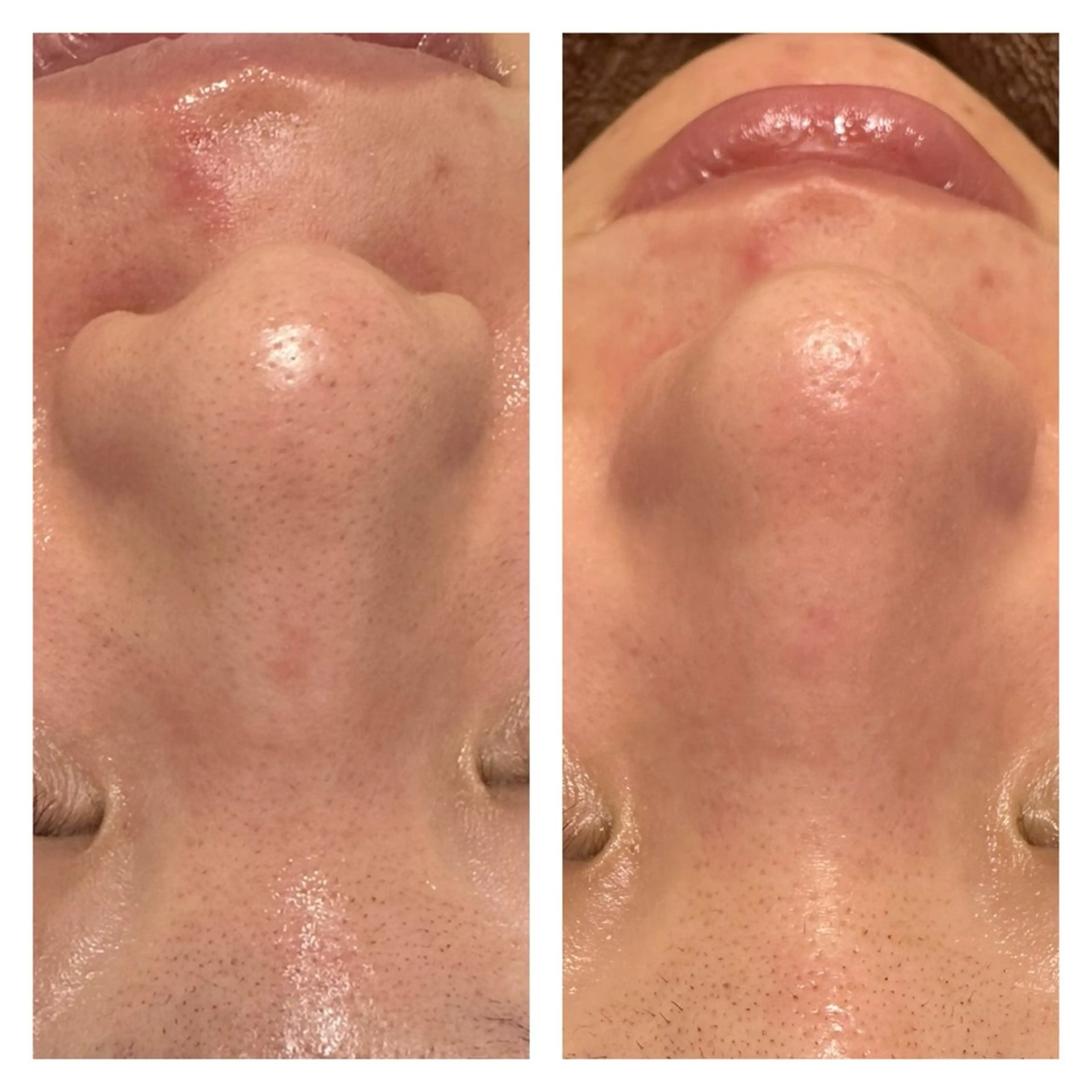 肌質を変えて すっぴん肌に✨のその他イメージ