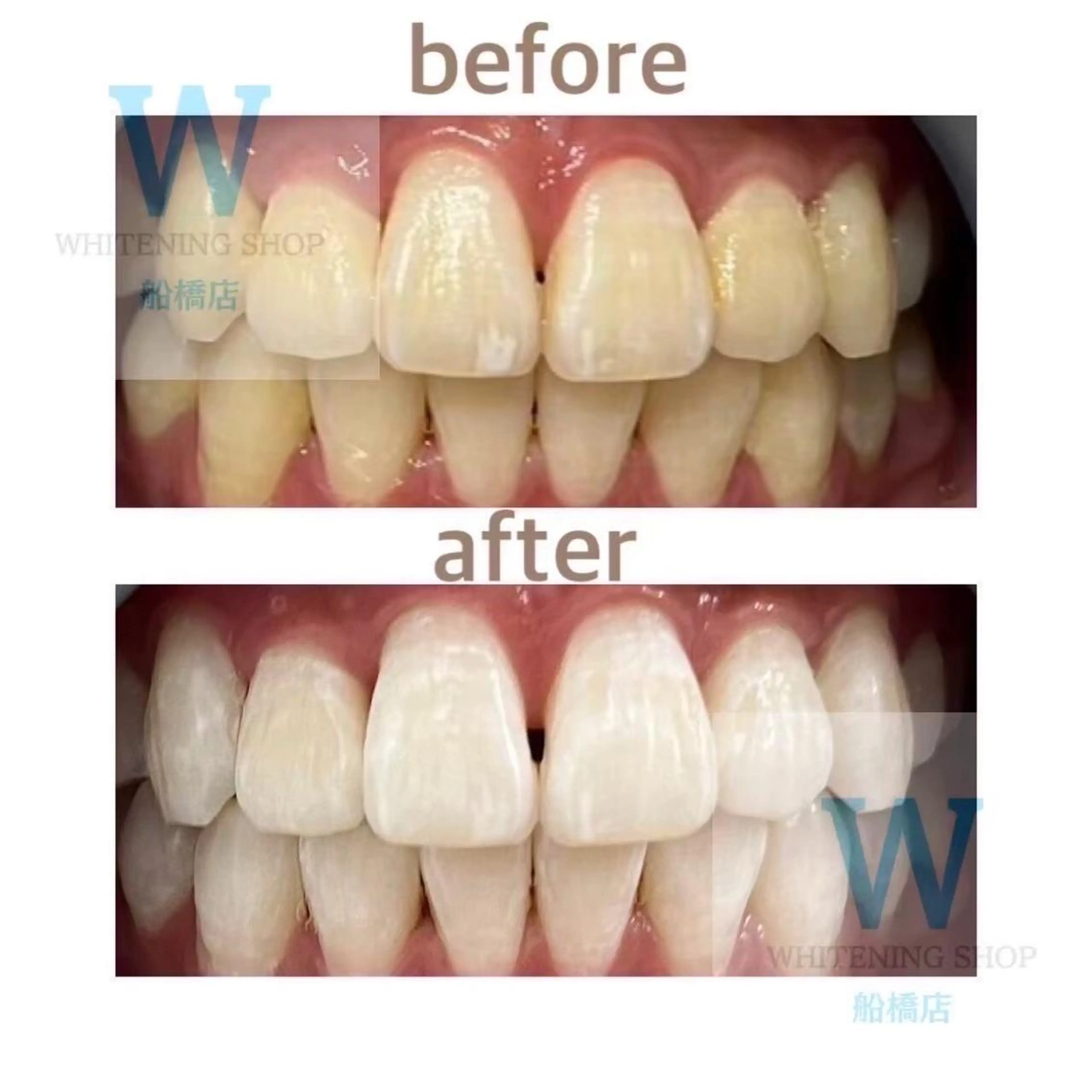 ホワイトニング ショップ船橋店🦷のエステ・リラクイメージ