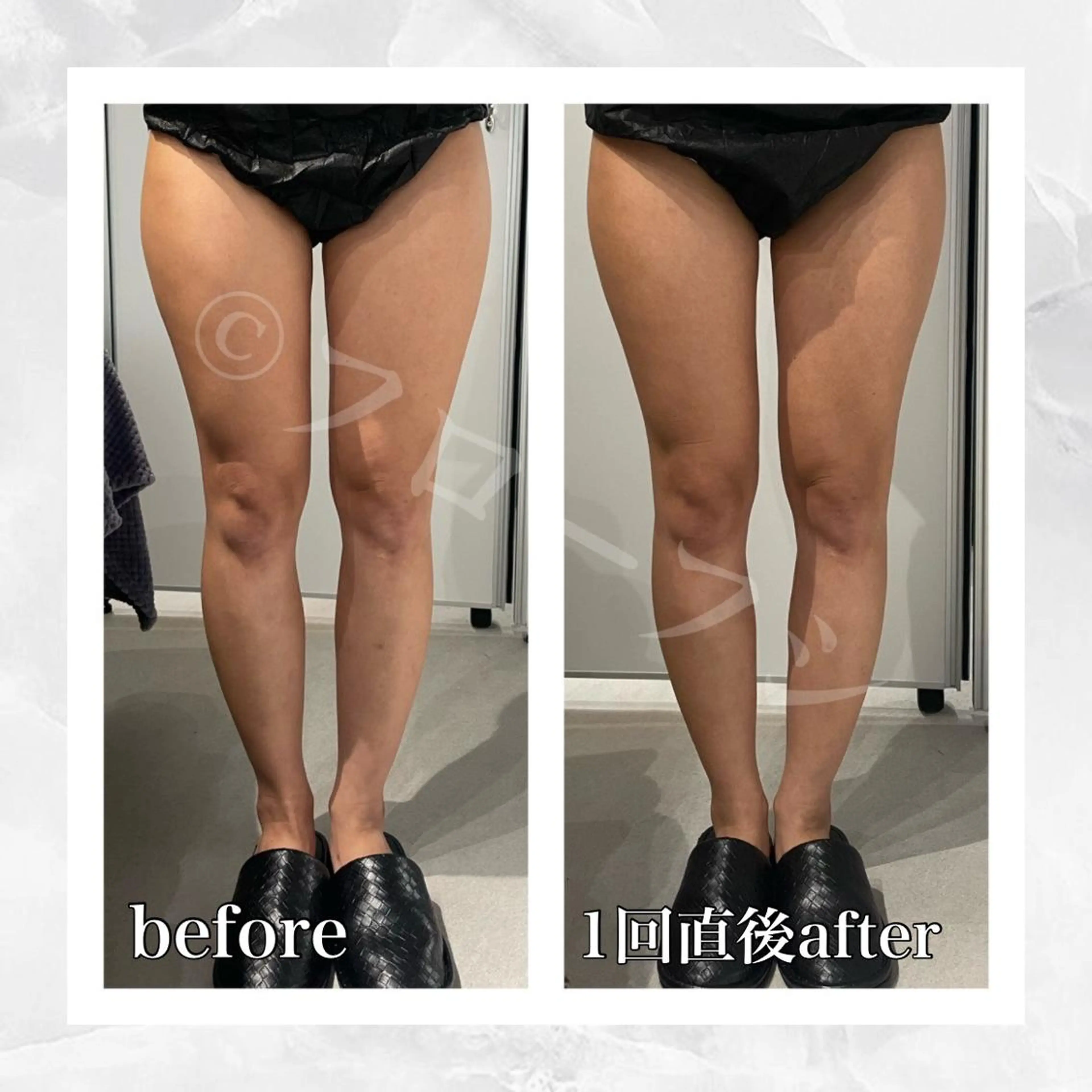 エステ リラク 部分痩せ♥️小顔専門 MIKUのエステ・リラクイメージ