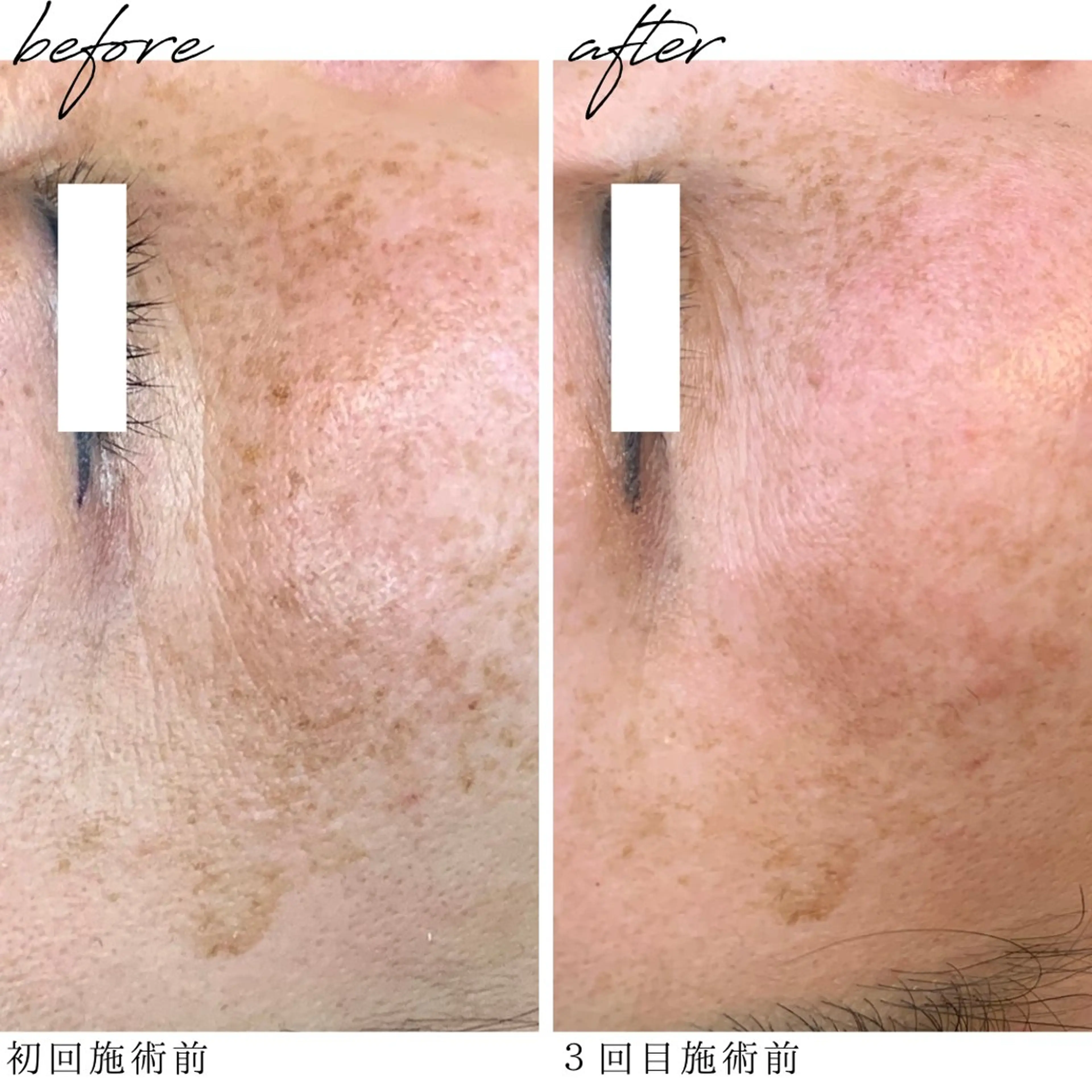 最新シミケアLily de pearlのエステ・リラクイメージ