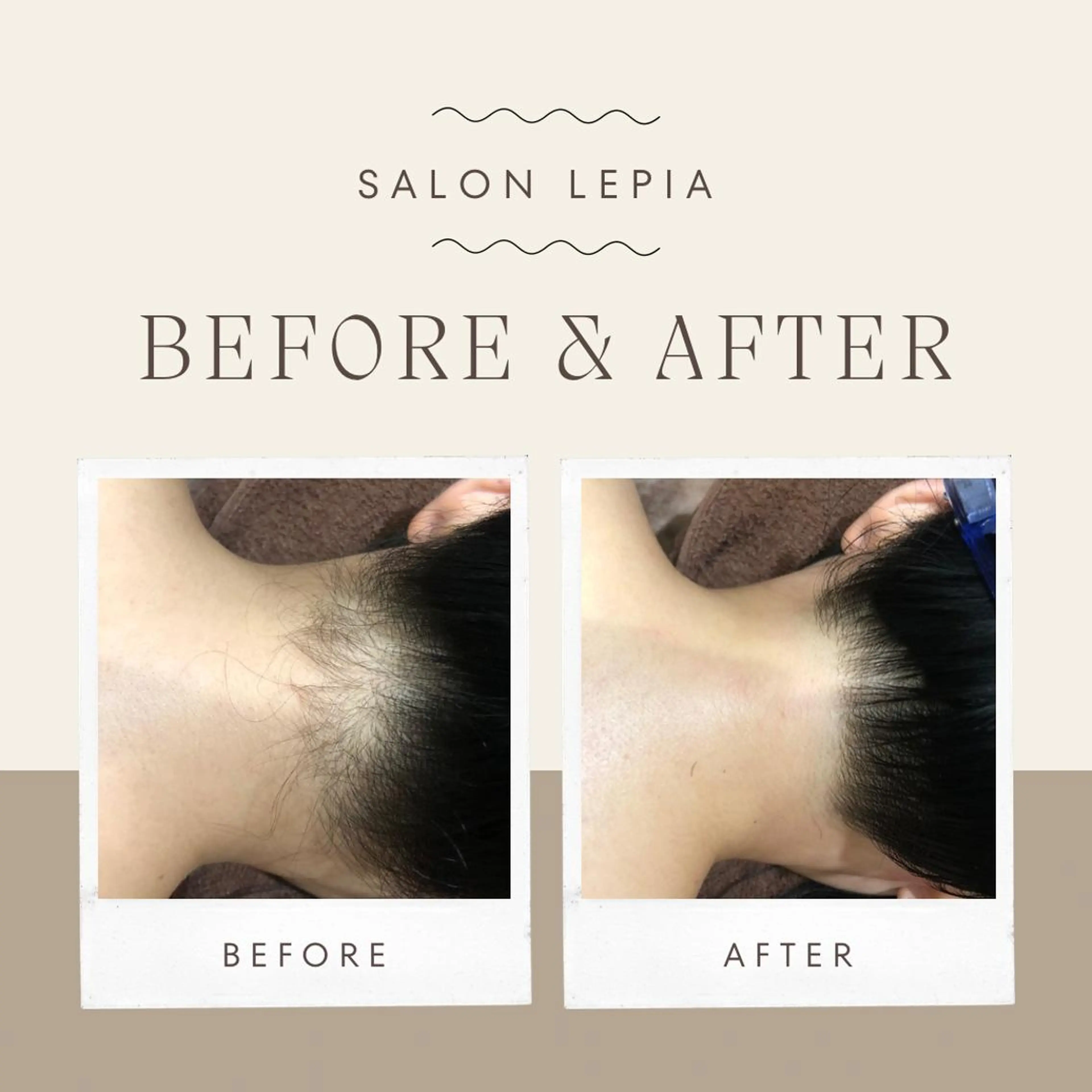 男女同額脱毛エステ salonLEPIAのエステ・リラクイメージ