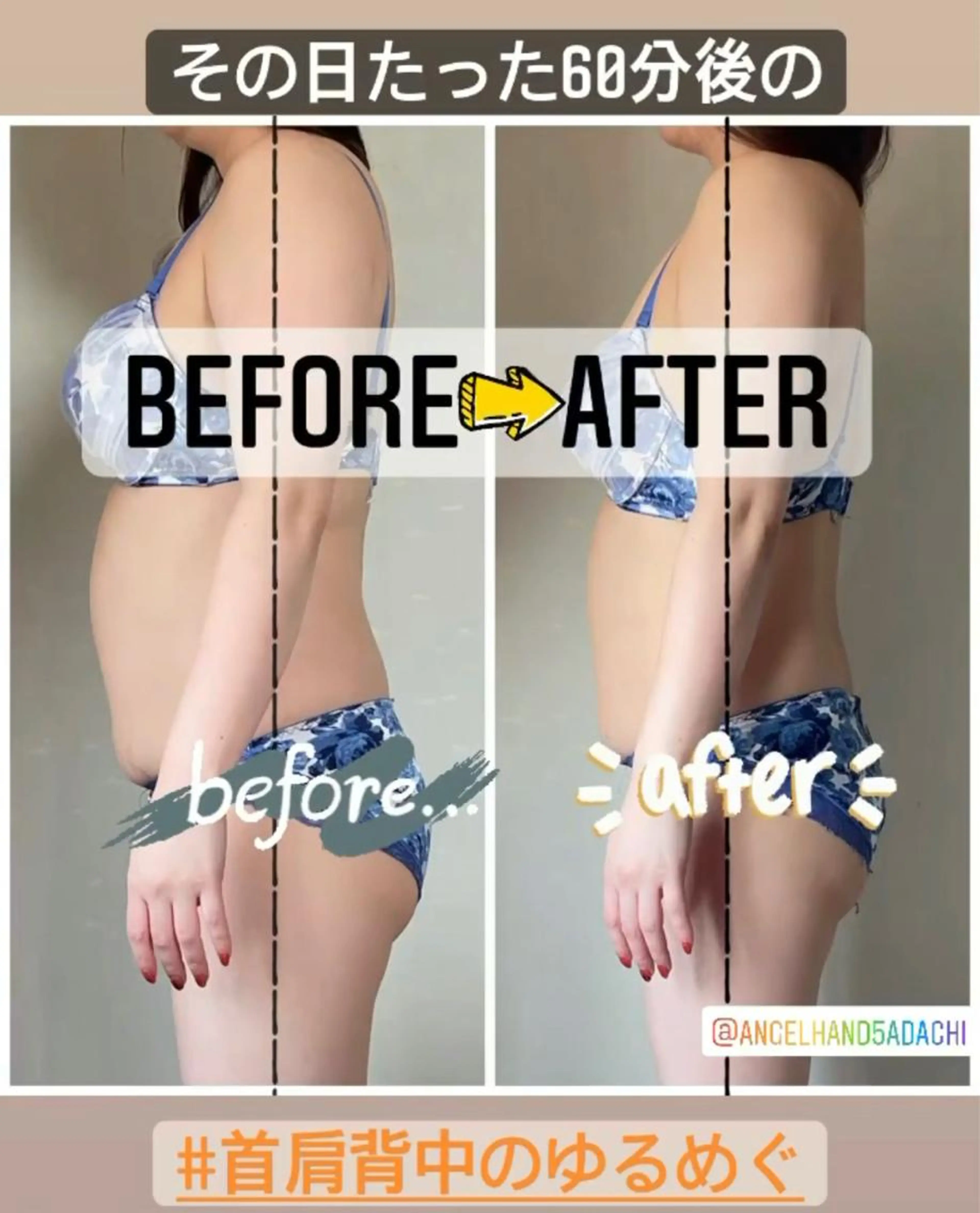 首肩背中のゆるめぐフルオプションの写真