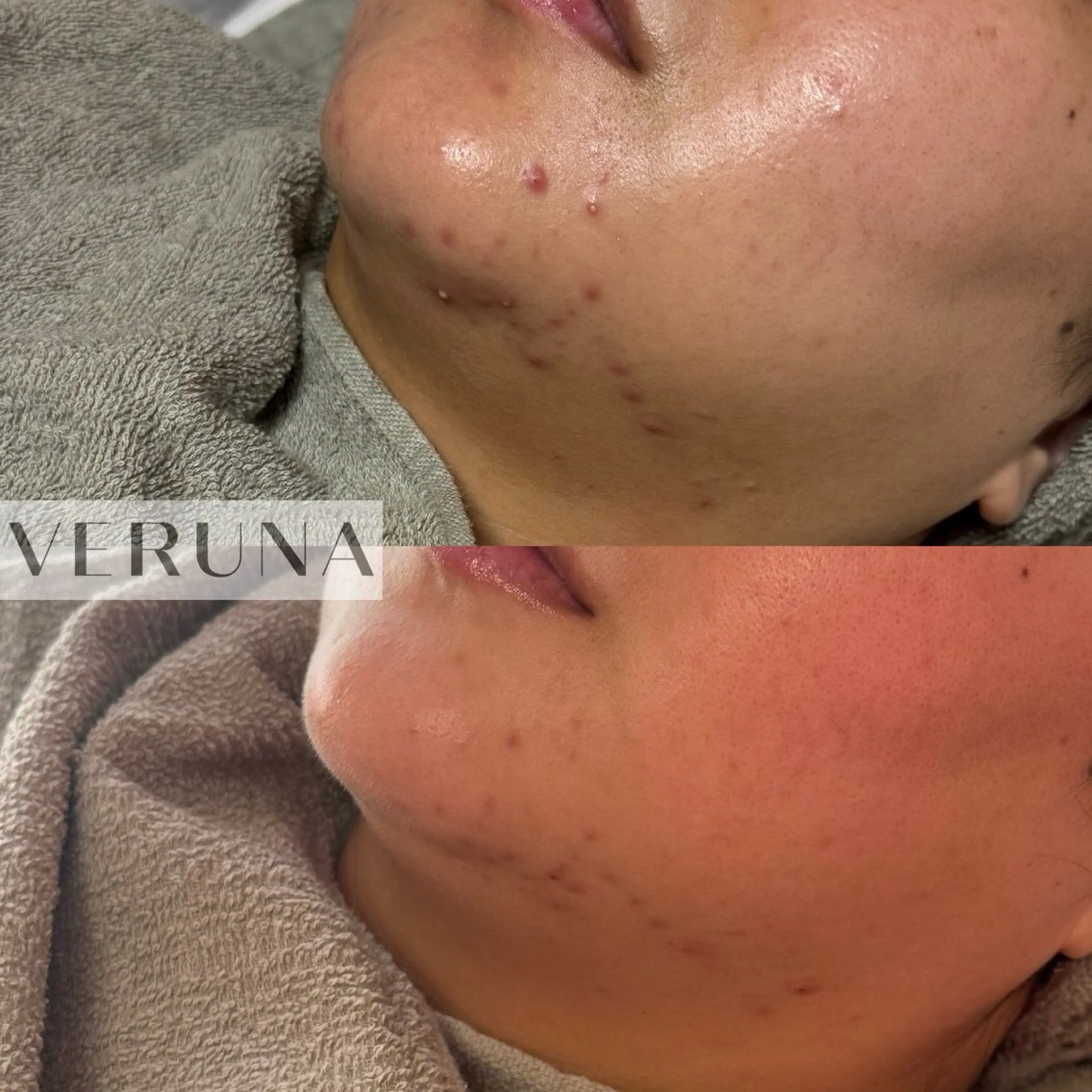 ハーブピーリング専門 葵/LUNEAのエステ・リラクイメージ