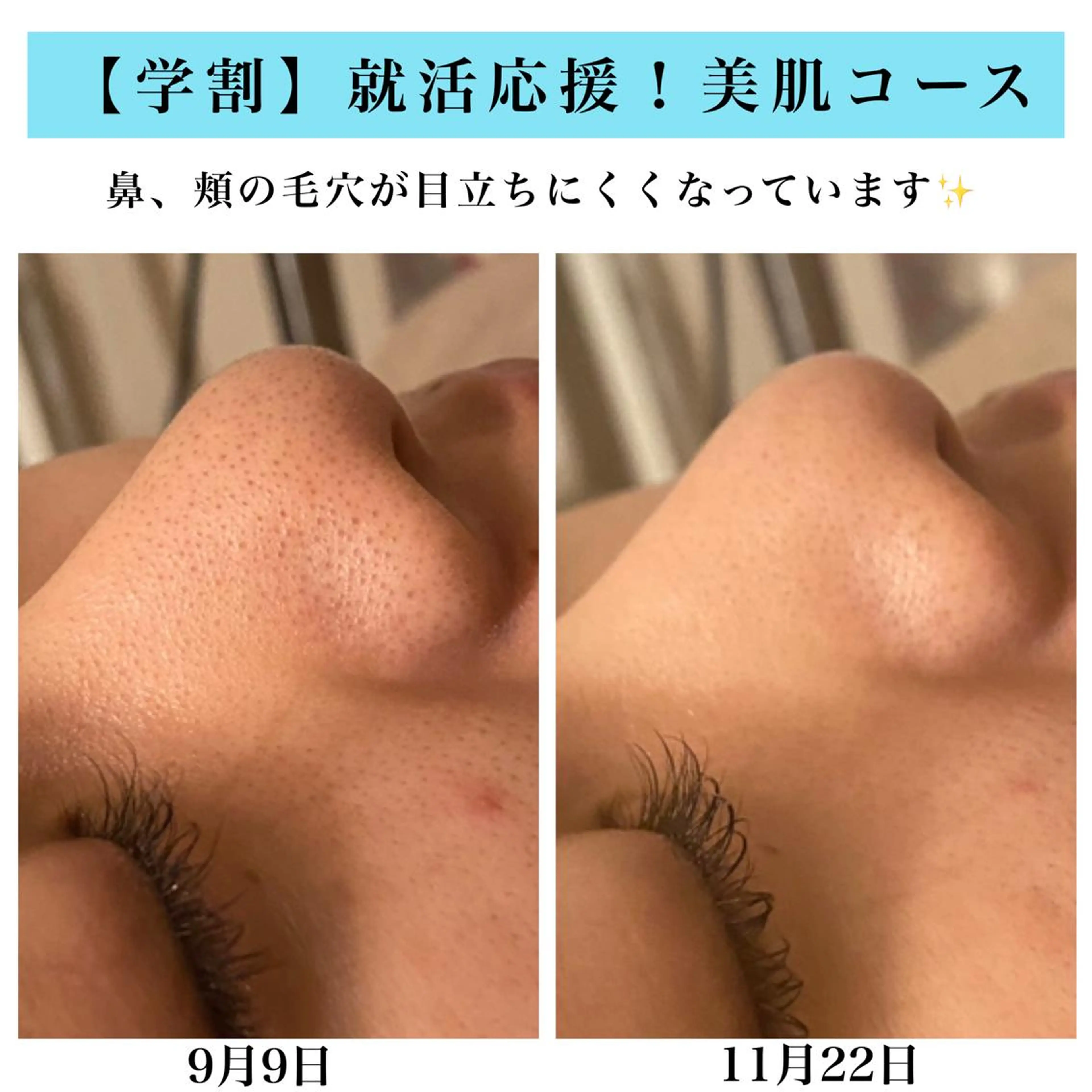 Bellesthe (ベルエステ)のエステ・リラクイメージ