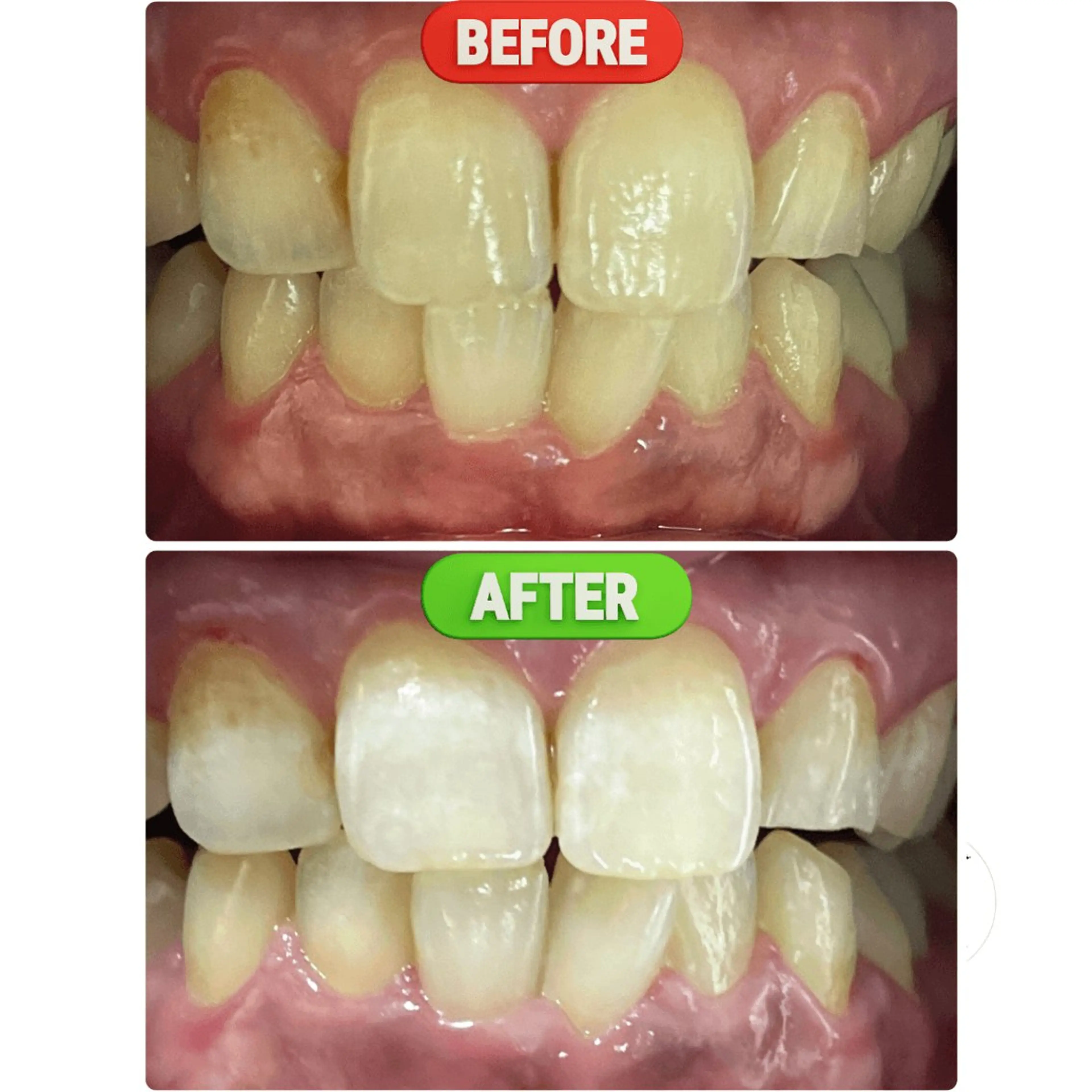 東区香椎歯のセルフホ ワイトニングGLOWのその他イメージ