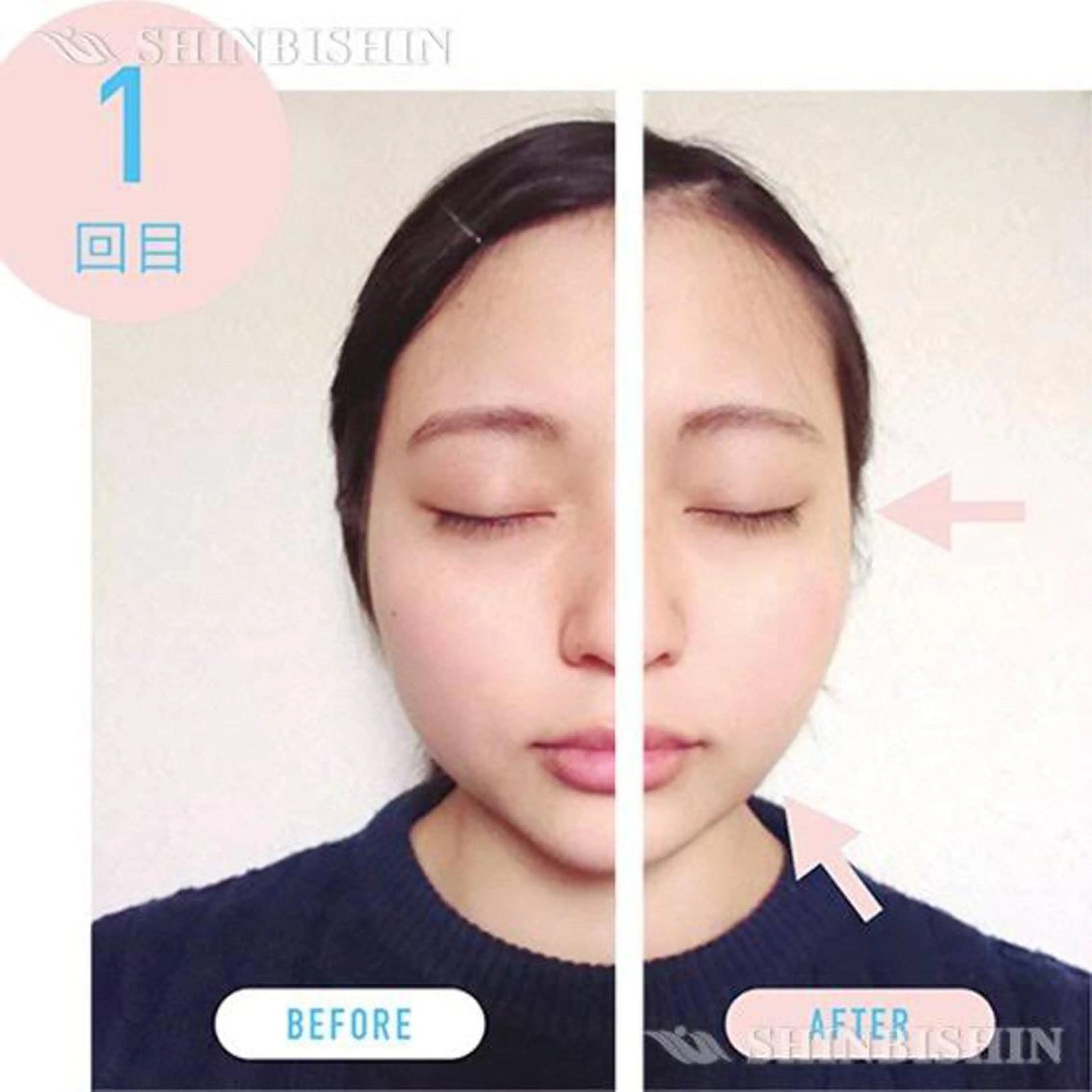 【医療提携エステ】 ルミナス北浦和のその他イメージ