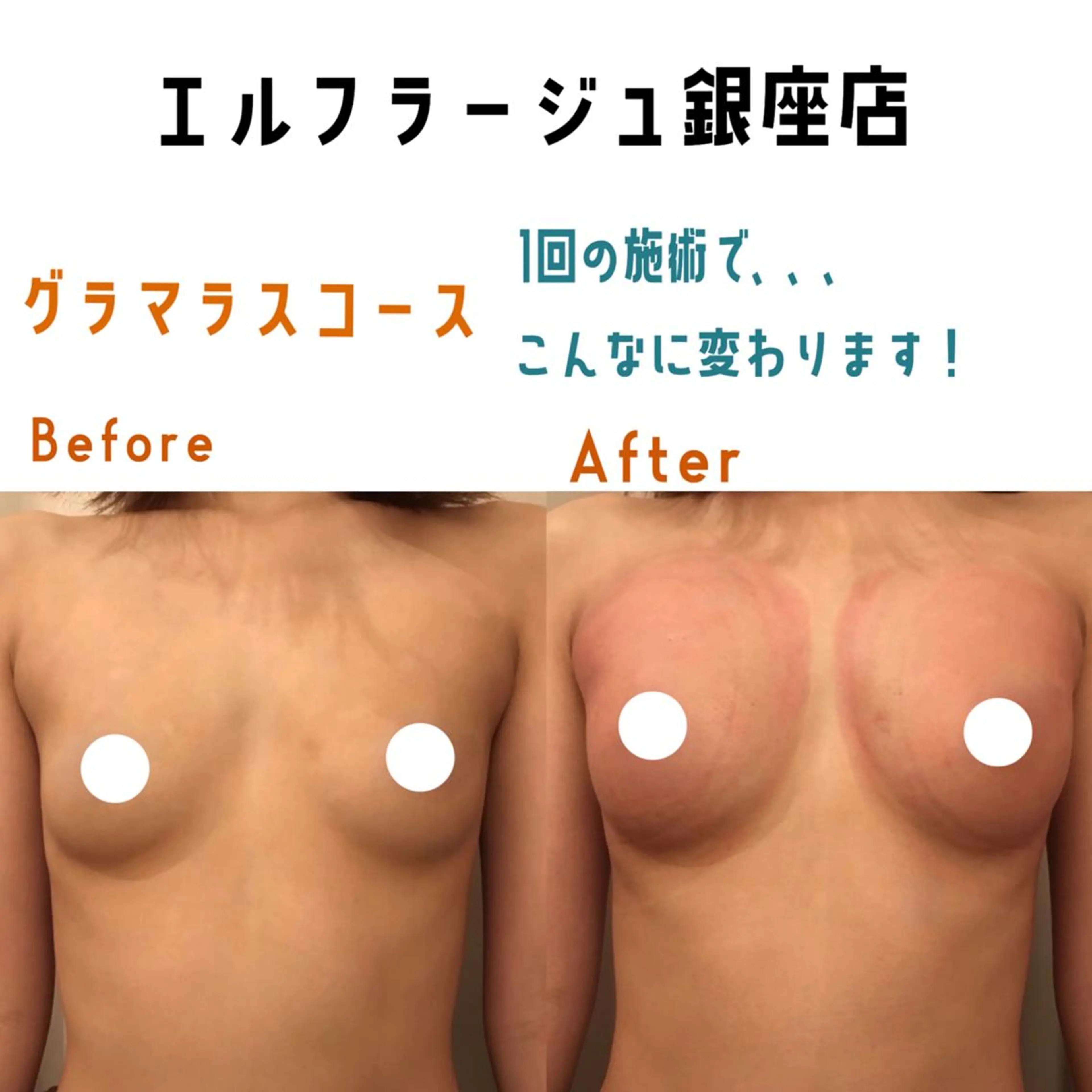 エルフラージュ 銀座店のエステ・リラクイメージ