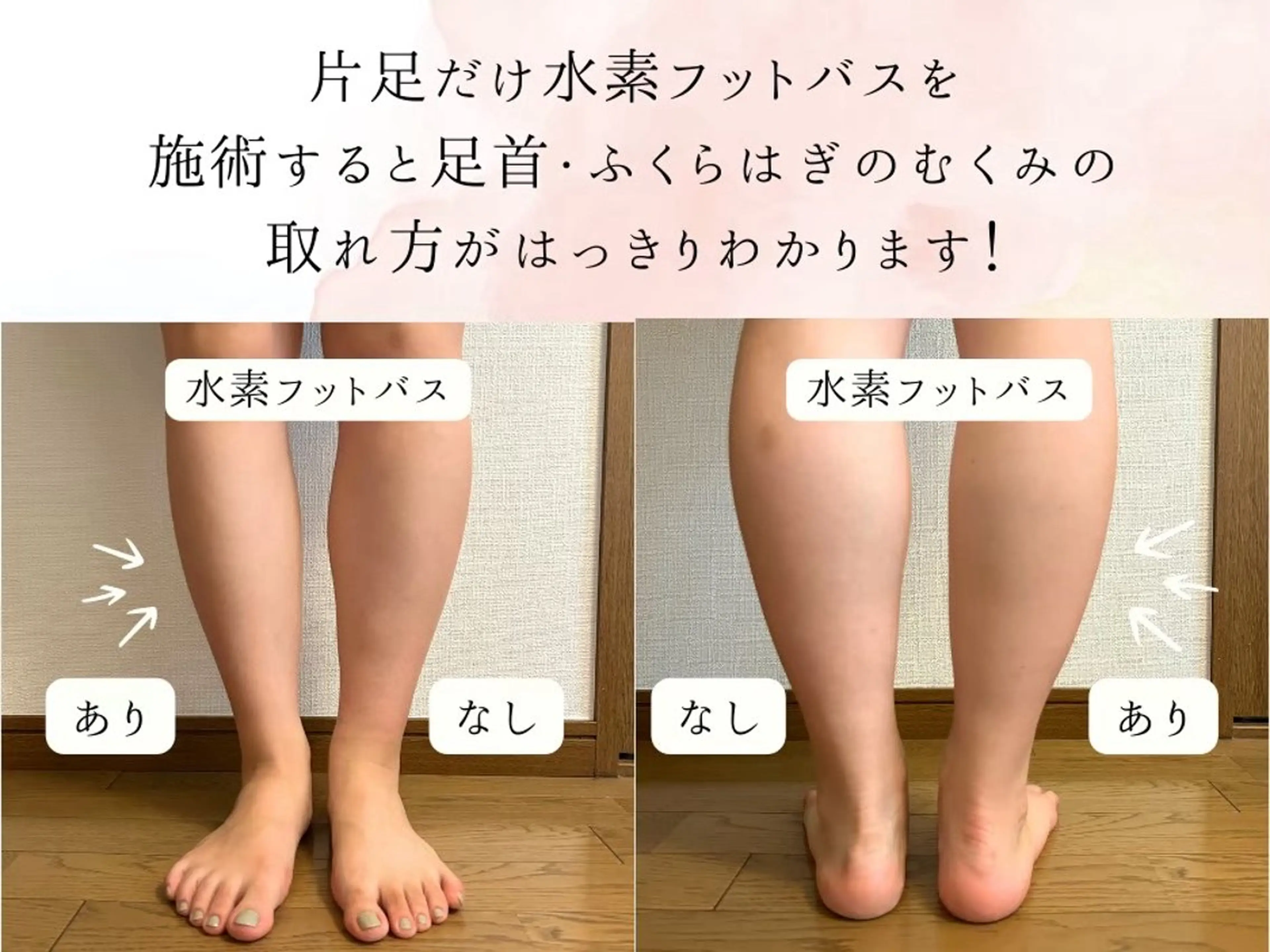 【西荻窪】本格痩身 最新型よもぎ蒸しのエステ・リラクイメージ