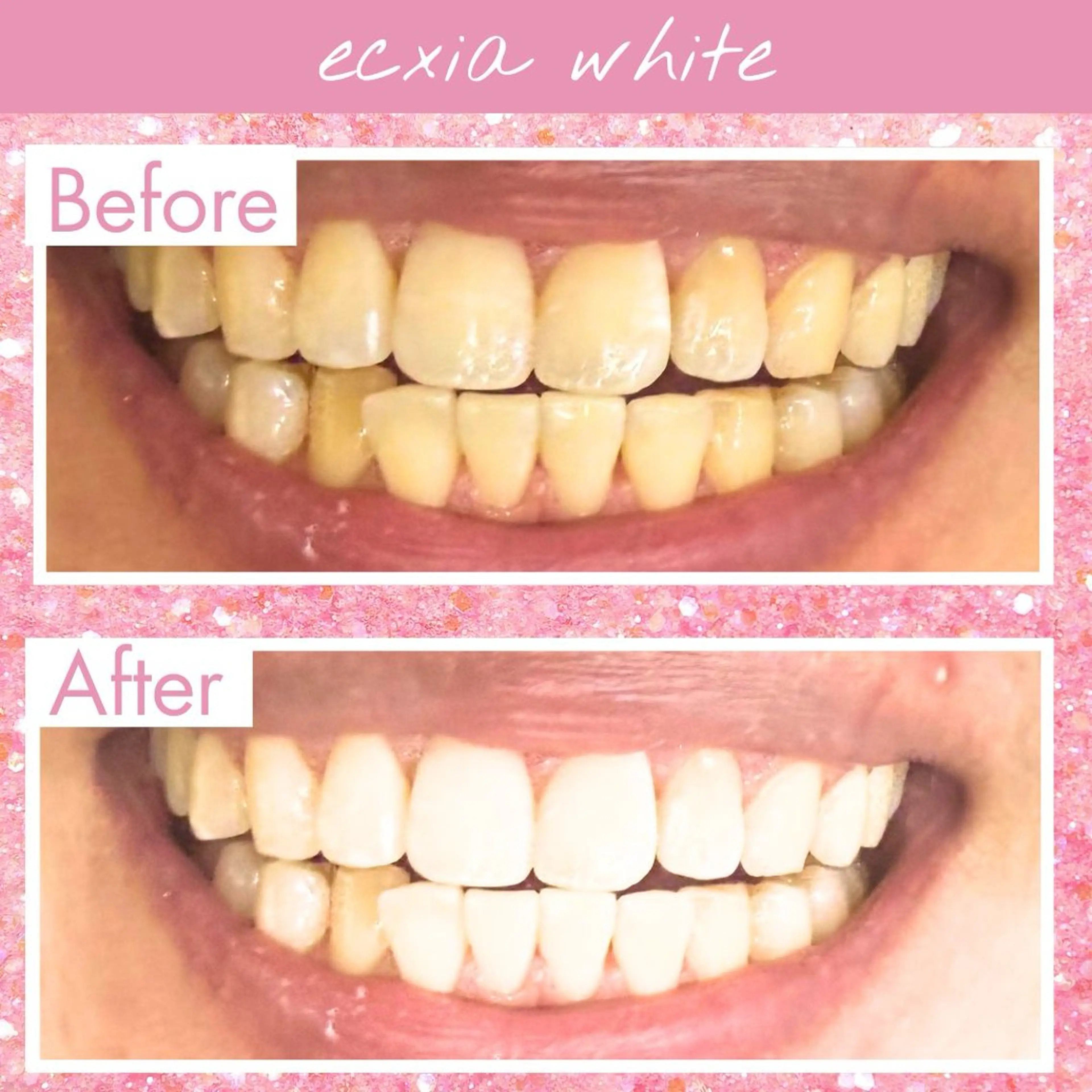 セルフホワイトニング エクシア宮崎花ヶ島店のその他イメージ