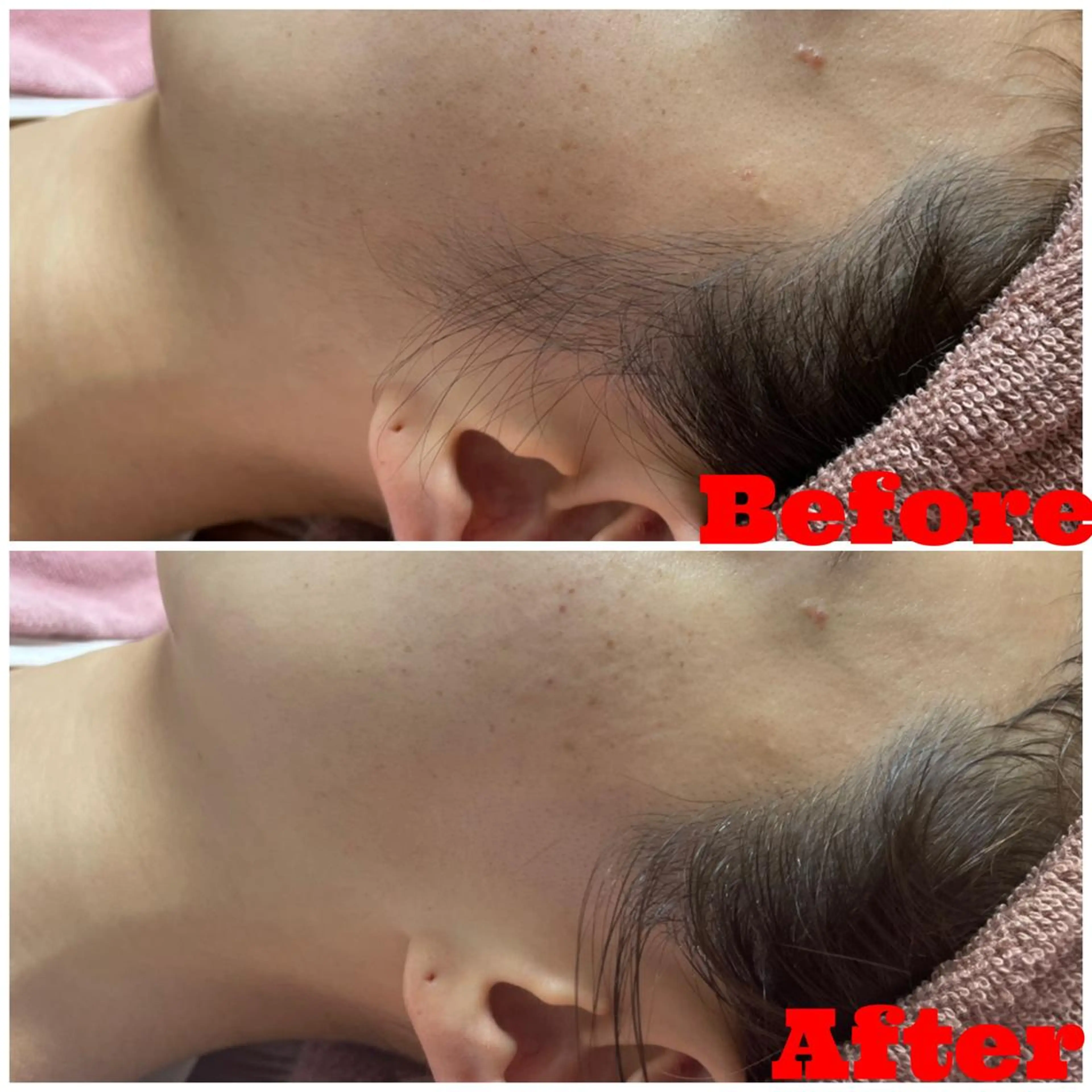 脱毛 Linomalie エステ/たるみ/脱毛のエステ・リラクイメージ