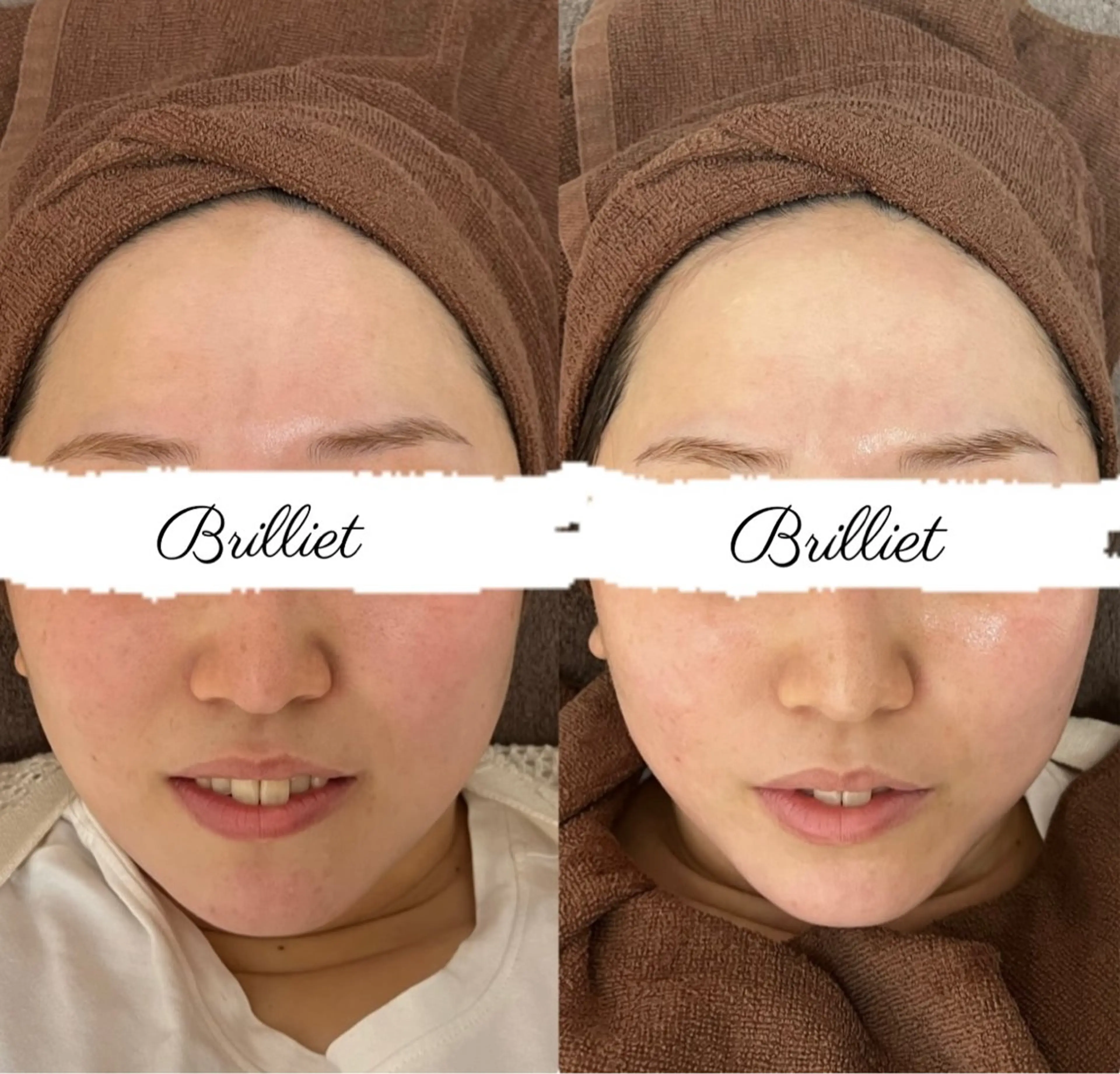 ブリリエット 文山のエステ・リラクイメージ