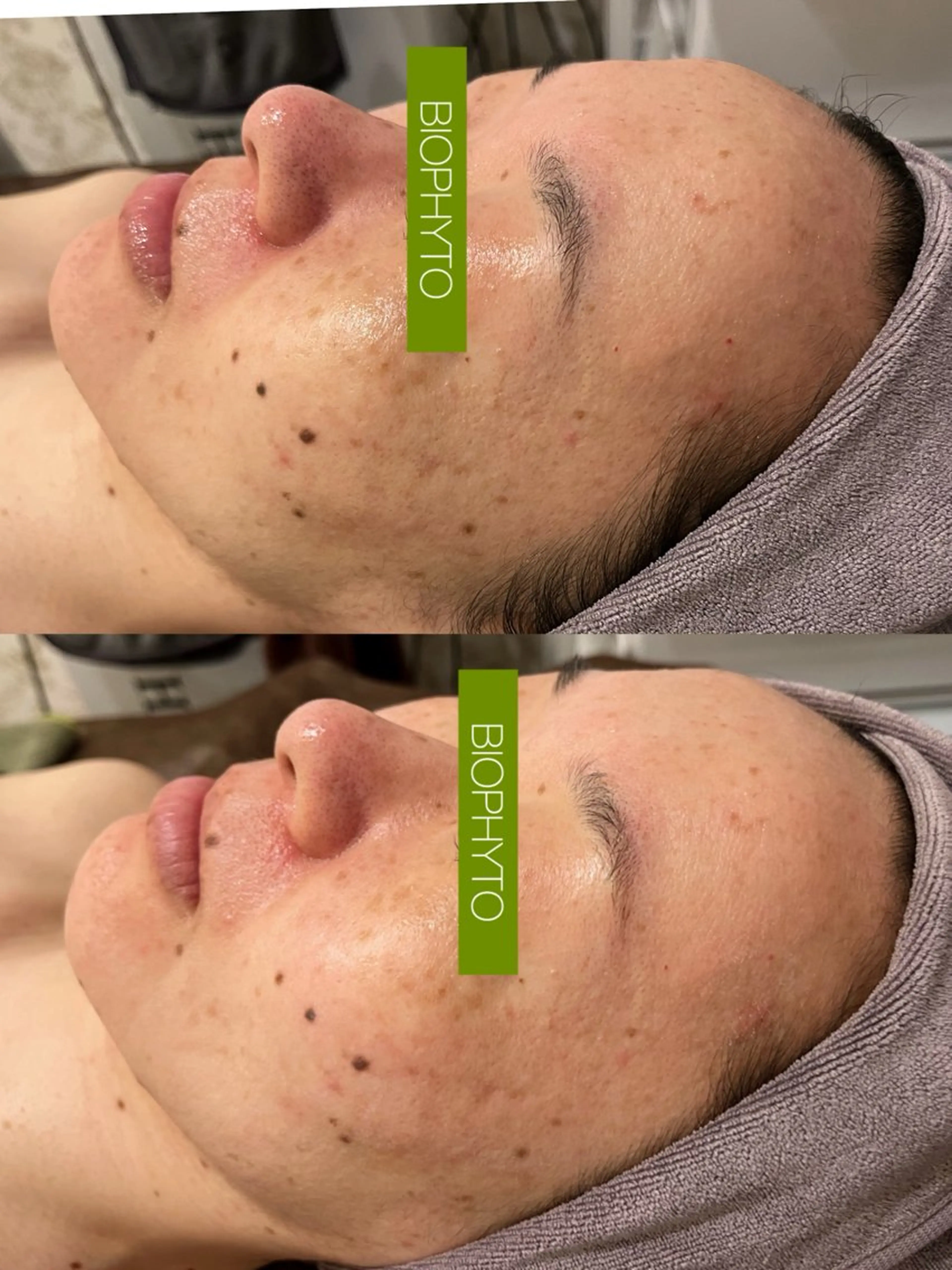 小顔コルギ ☆表参道/外苑前のエステ・リラクイメージ