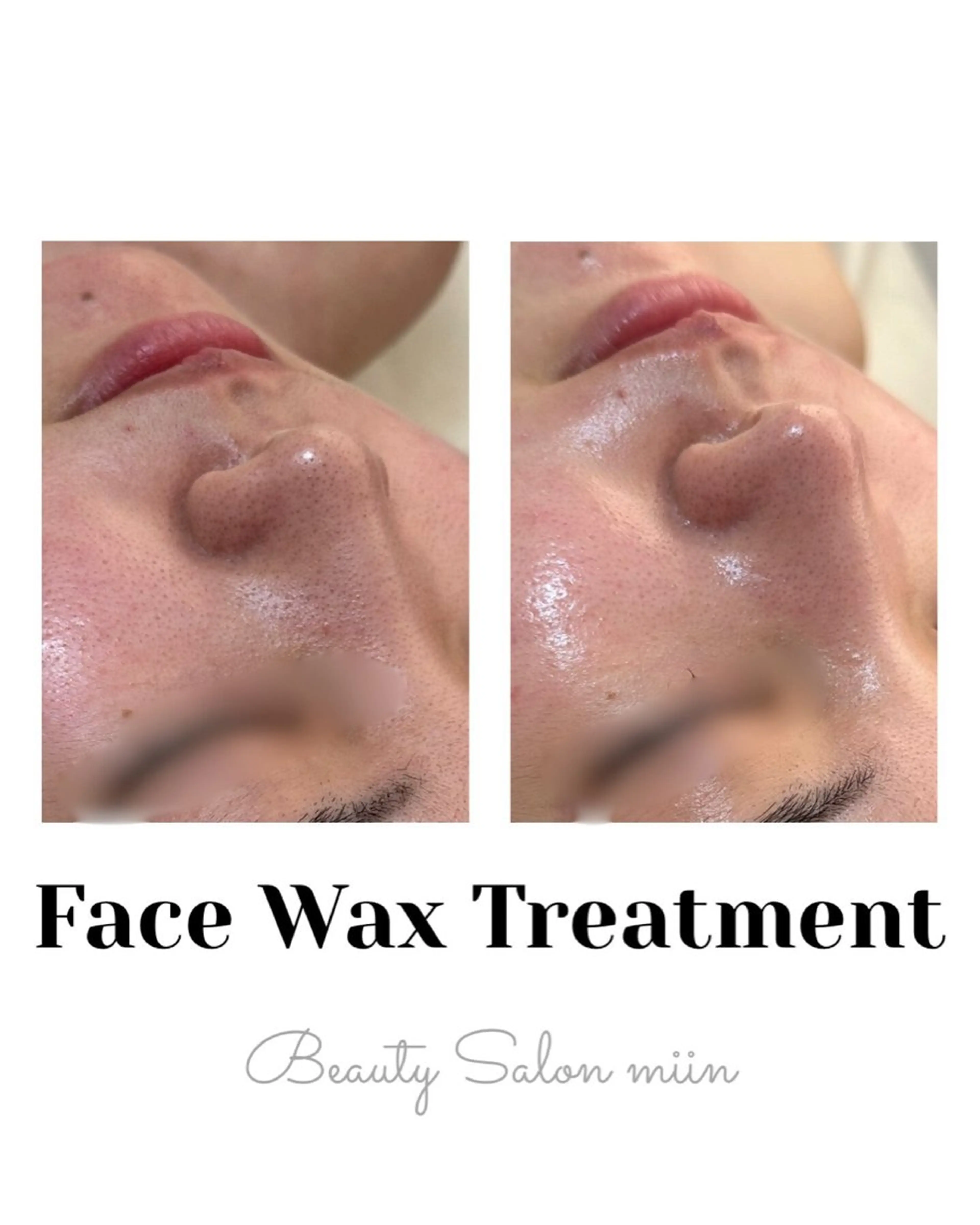 リラク 韓国肌管理 白玉肌管理®︎のエステ・リラクイメージ