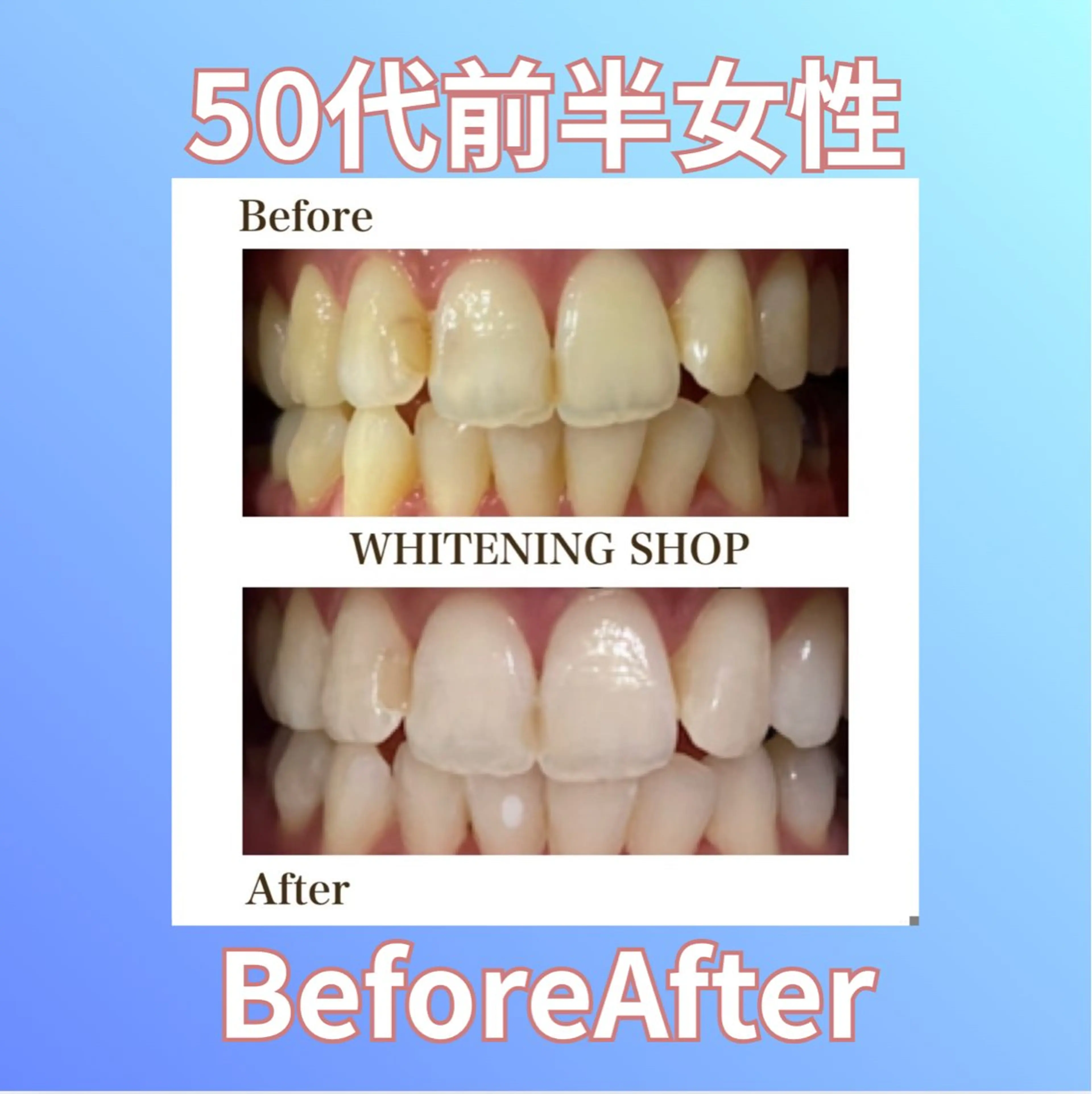 ホワイトニングショップ西原所属・下川 藍子のその他イメージ