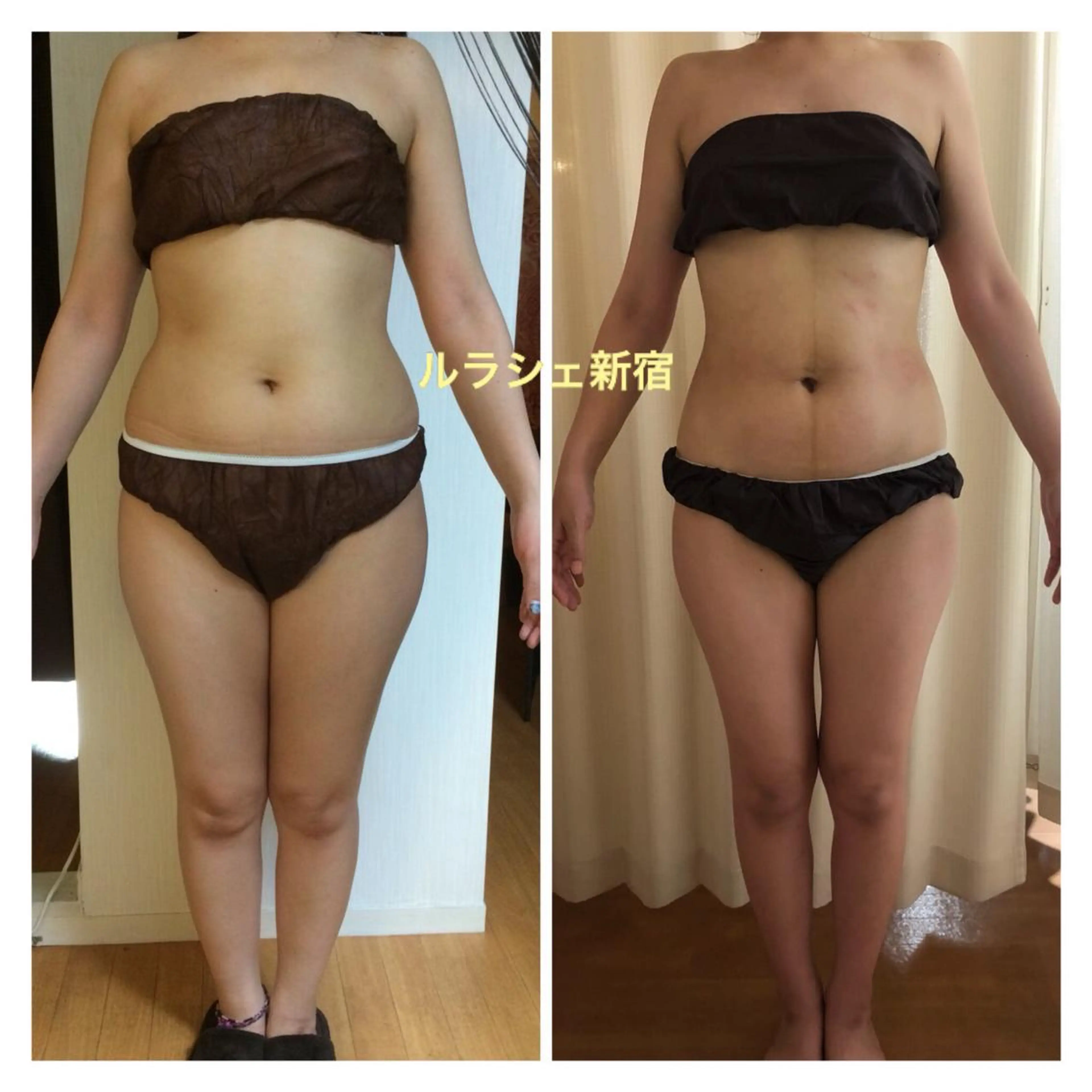 【痩身】インドエステ ＆筋膜リリースのエステ・リラクイメージ