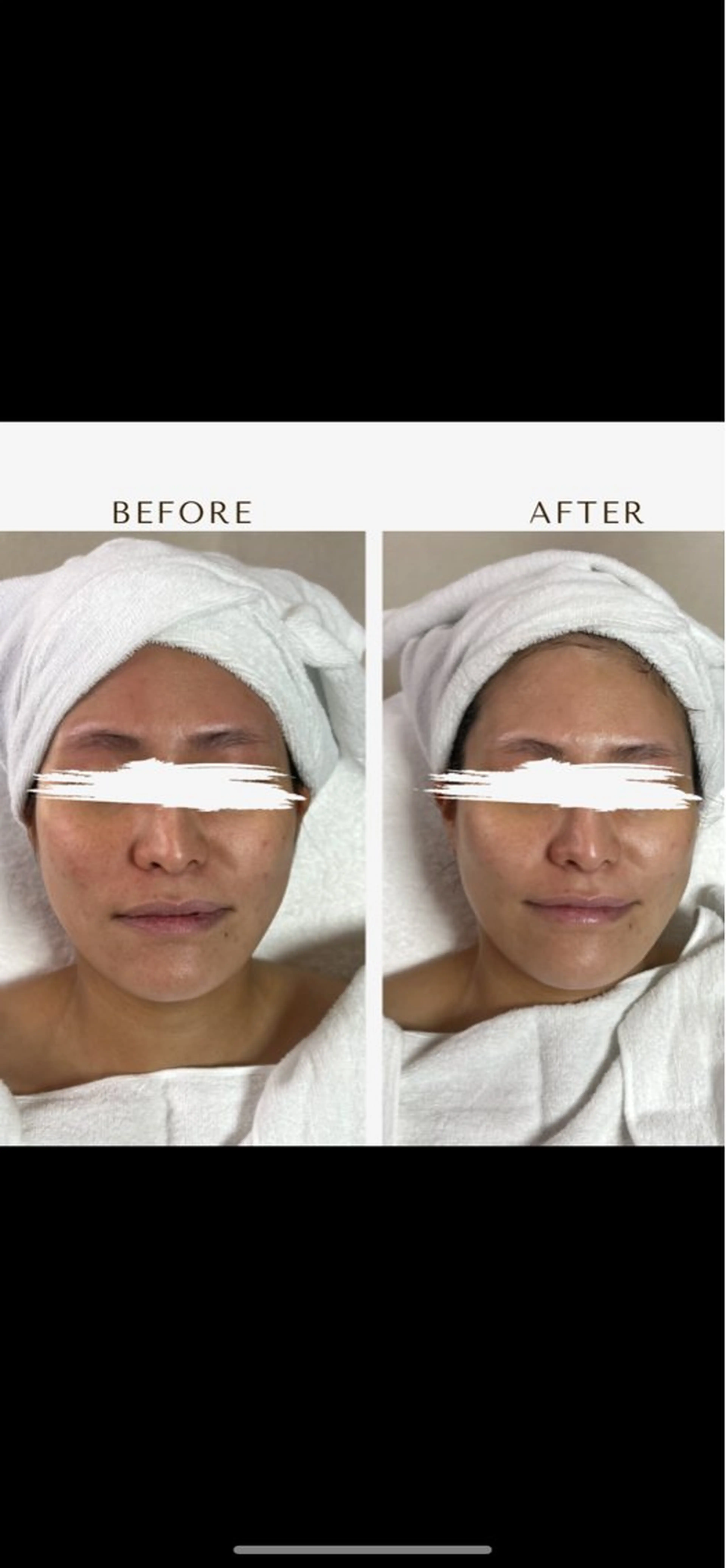 エステ ROR Akariのエステ・リラクイメージ