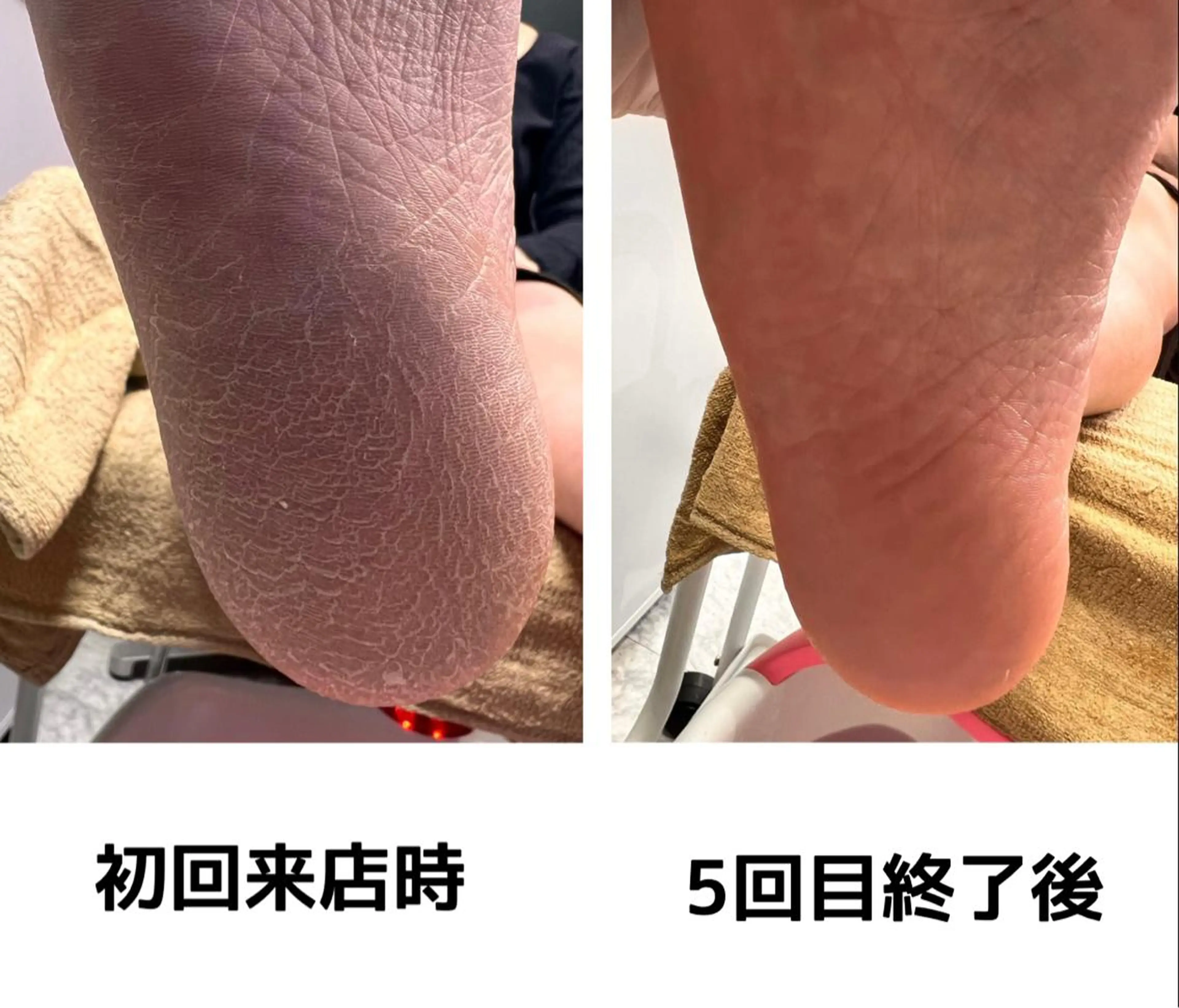 ネイル エステ 毛穴改善/脱毛 ネイル　川上久仁子のエステ・リラクイメージ