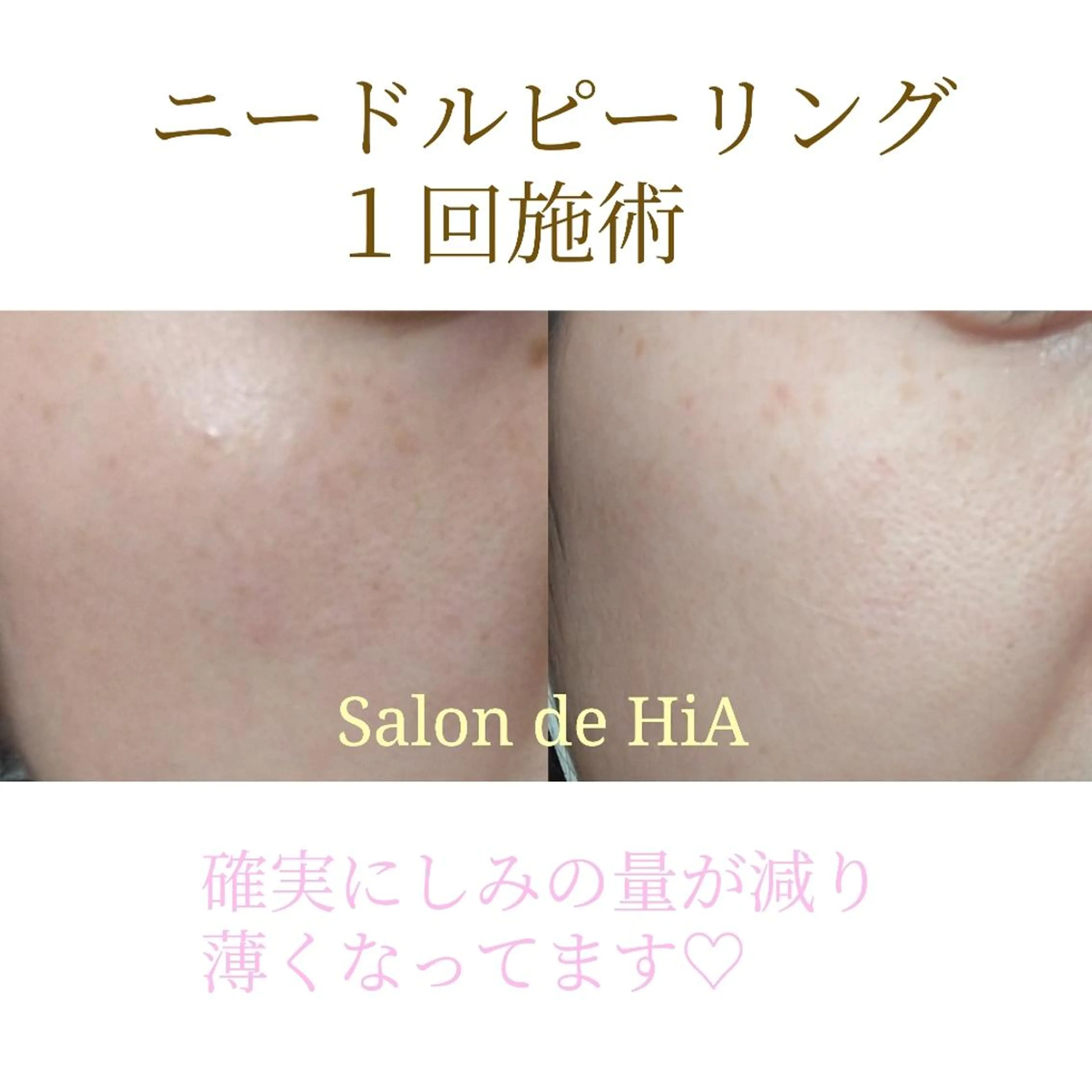 エステ Salon de  HiAのエステ・リラクイメージ