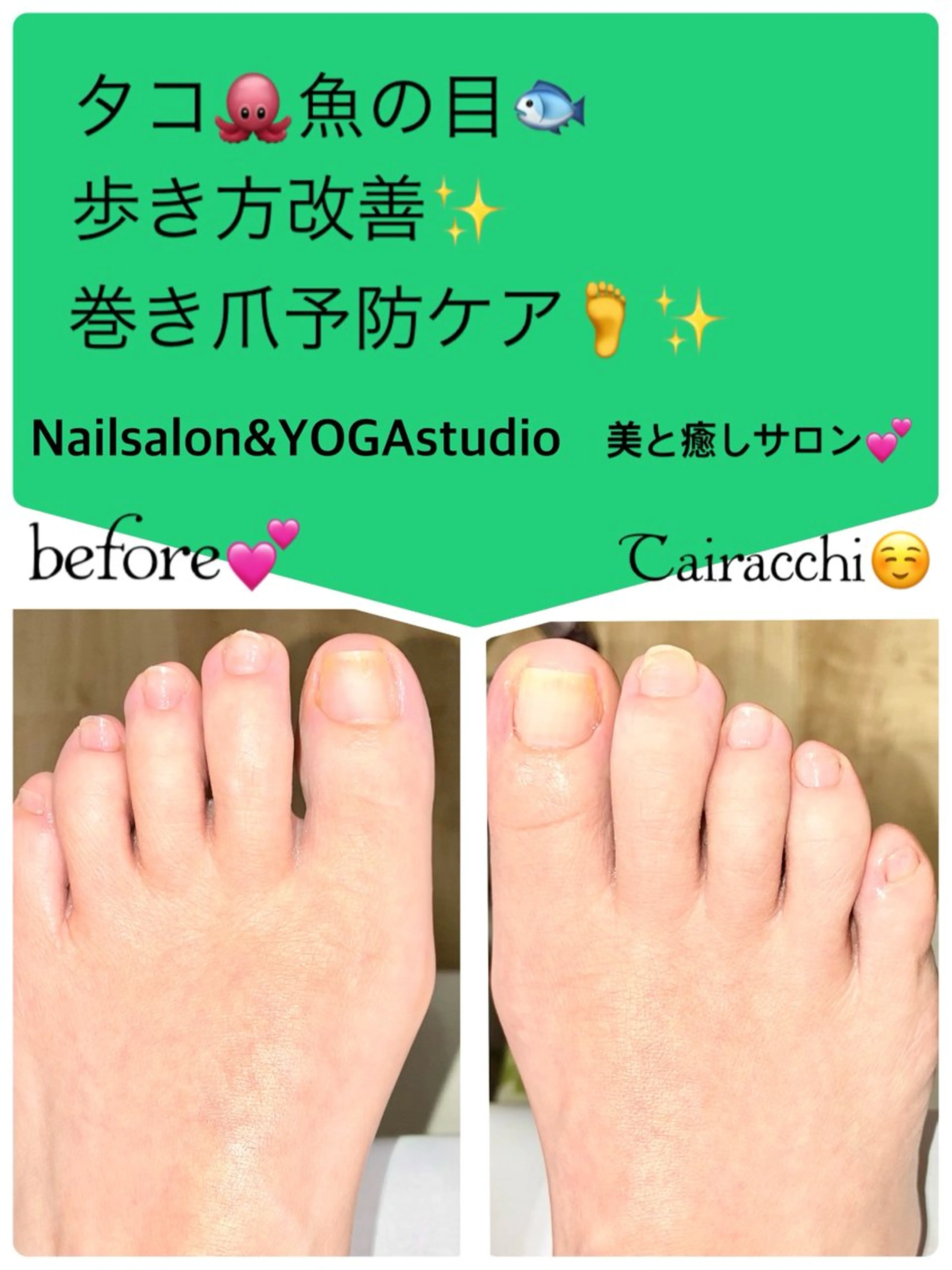 ネイル フットネイル フットネイル Tairacchi ﾀｲﾗｯﾁのエステ・リラクイメージ