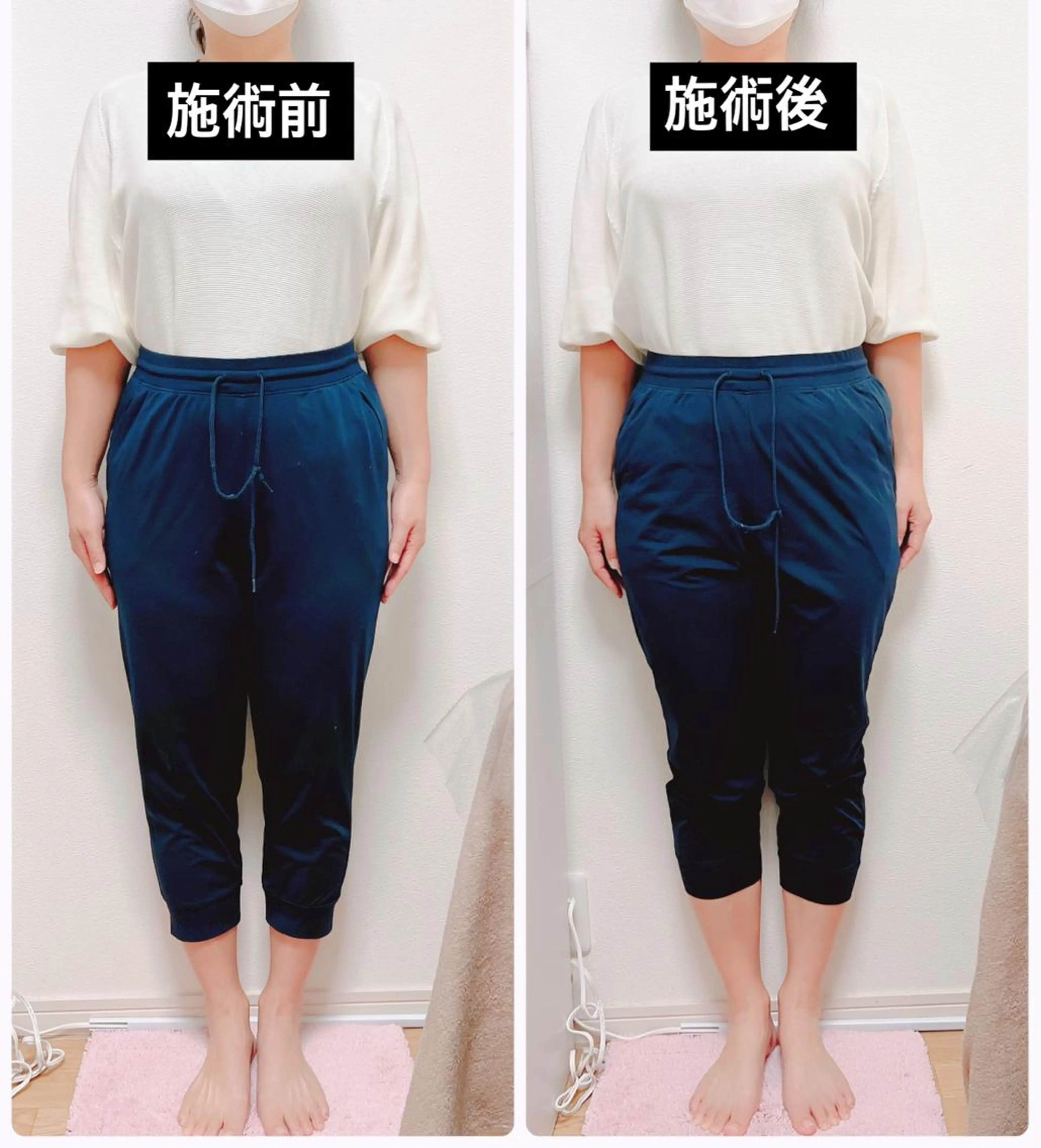 小顔と腸の専門店 ラクーラビューティのエステ・リラクイメージ