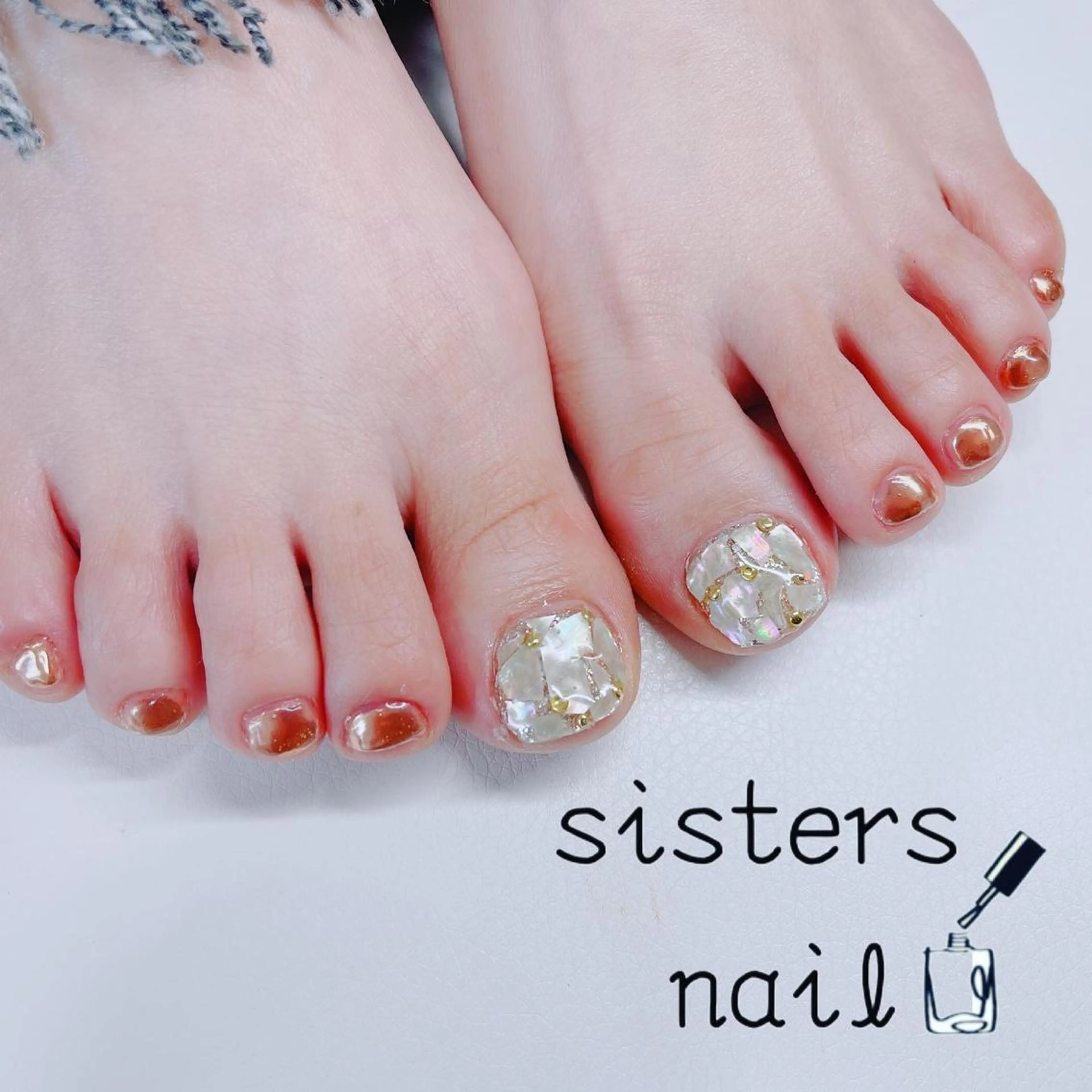 【巻爪解消】4週間に一回交換! ¥3000~(1本)の写真