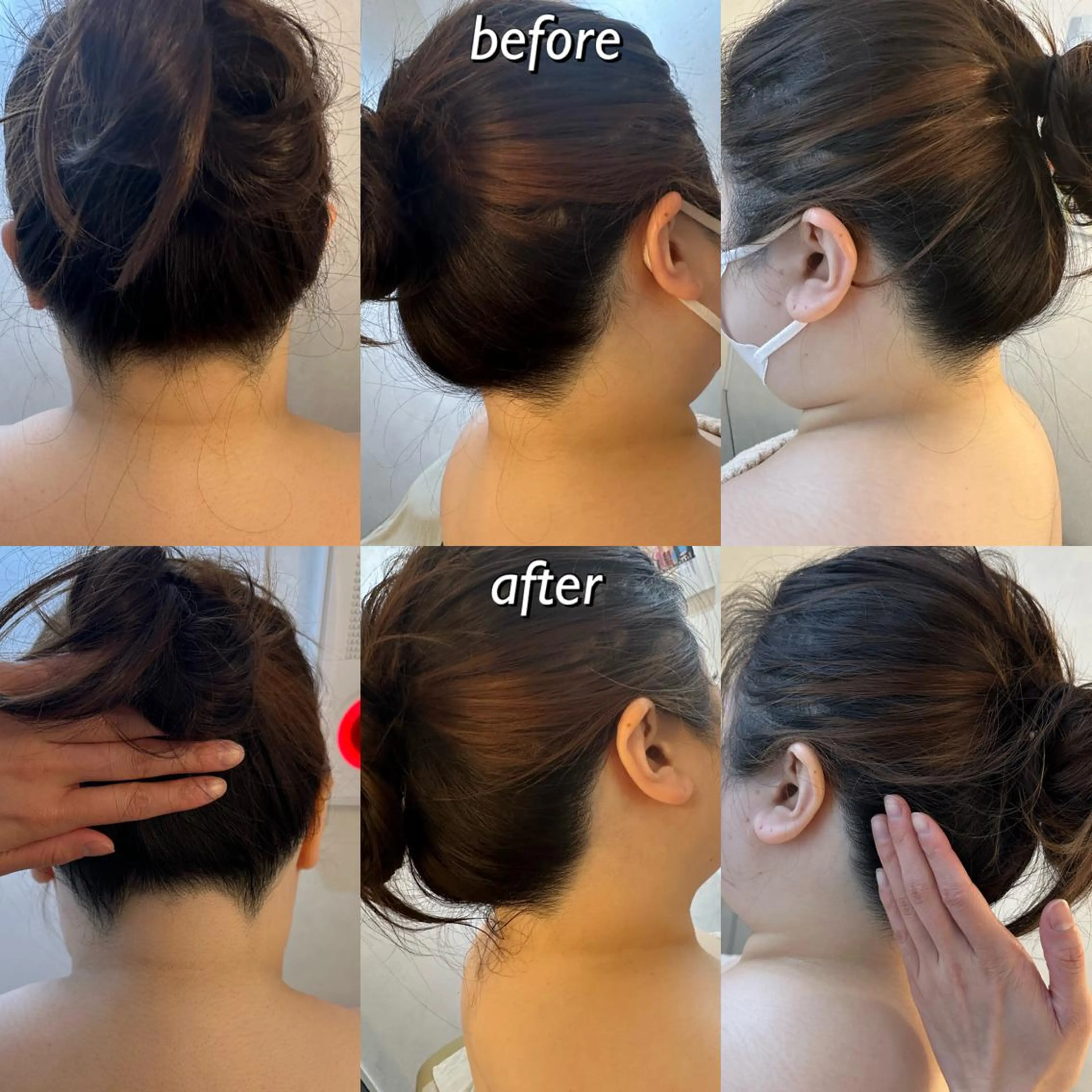 うなじ脱毛/美肌脱毛 LABELのエステ・リラクイメージ