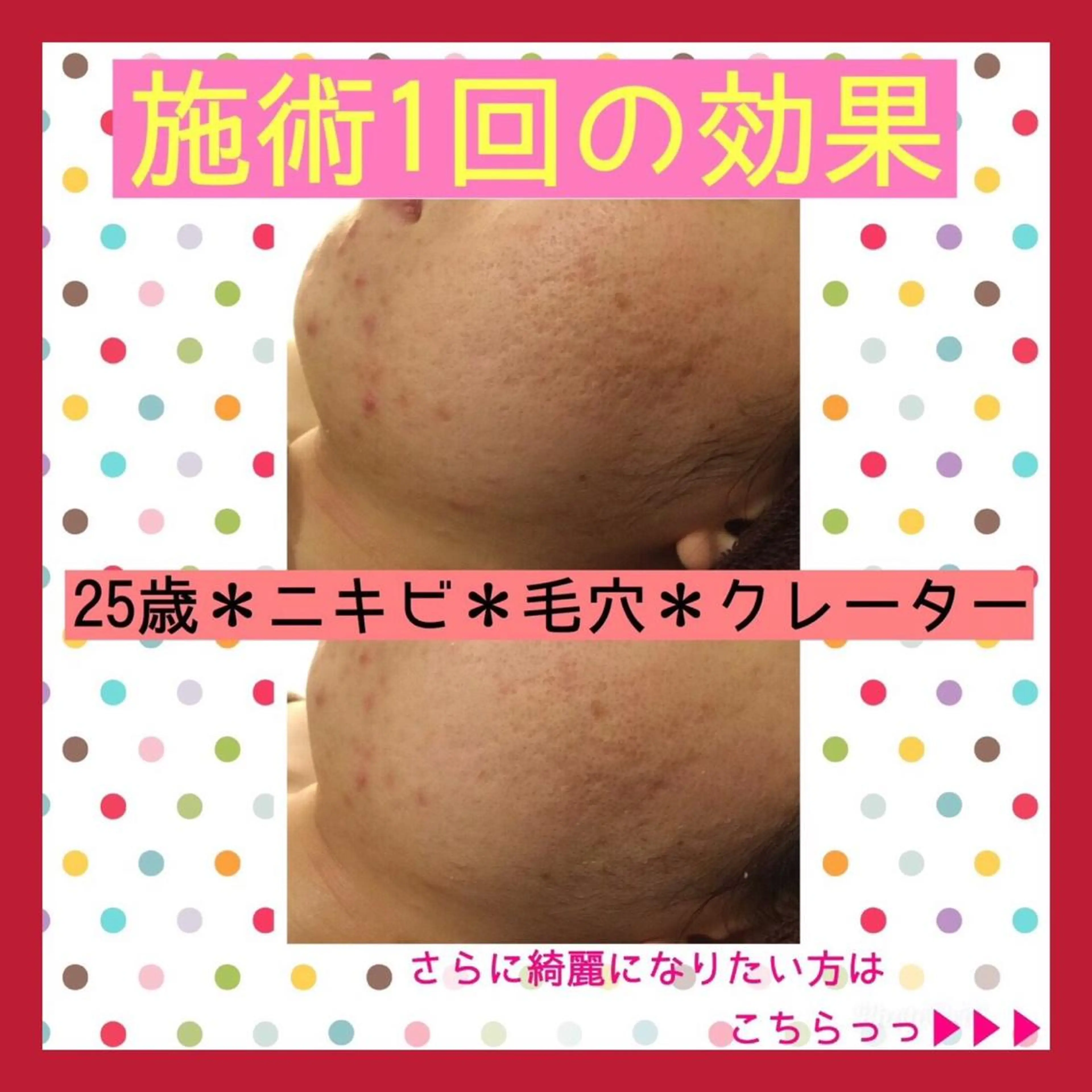 ミディアム カラー パーマ ヘアアレンジ メンズ キッズ ネイル マツエク・マツパ エステ リラク ニキビ・肌質改善専門 ♡人生が変わるサロンのエステ・リラクイメージ